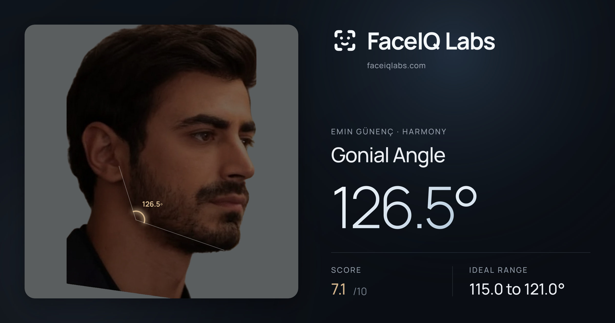 Emin Günenç Gonial Angle: 126.5°, drawn on the photo