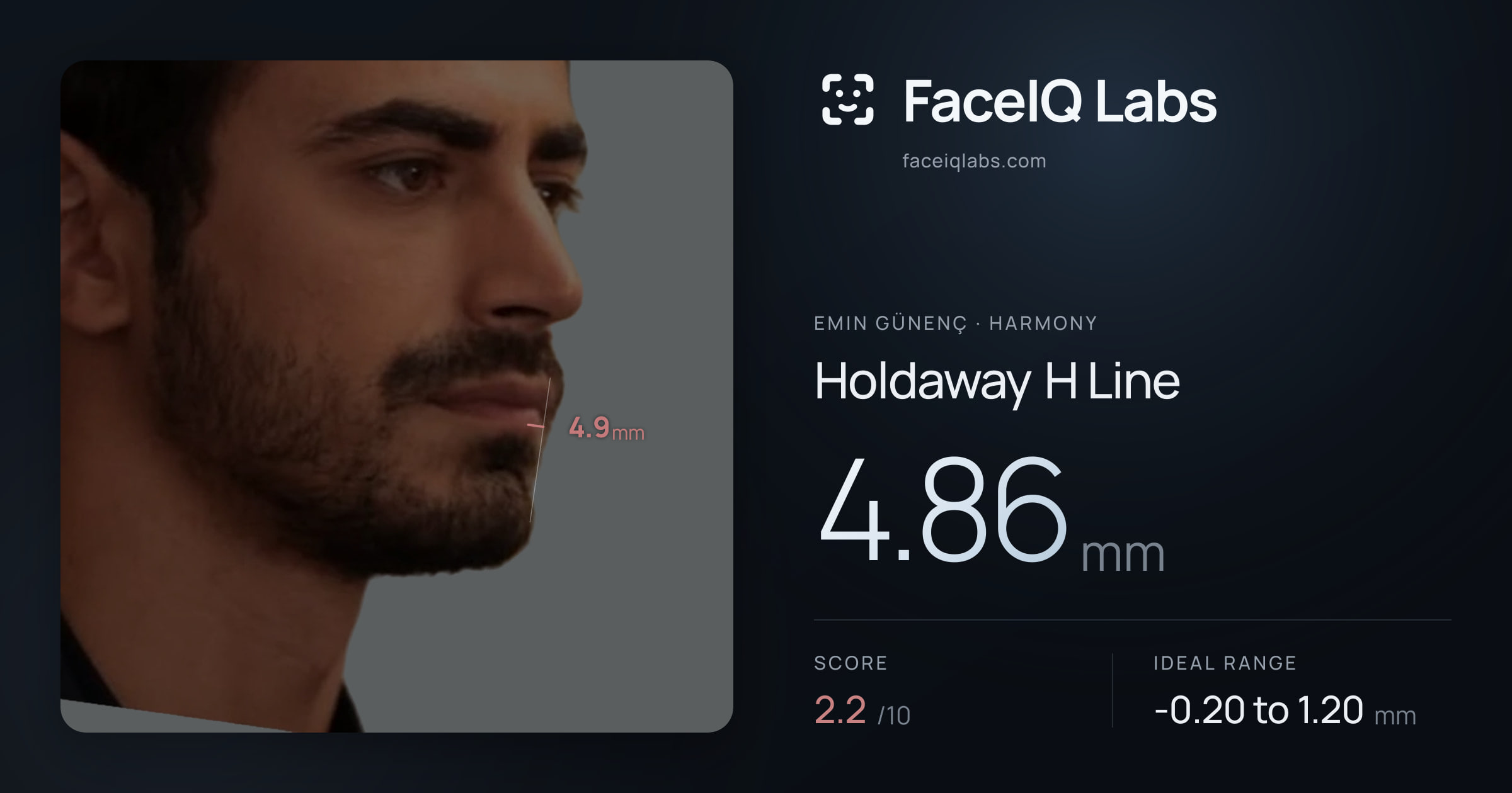 Emin Günenç Holdaway H Line: 4.86mm, drawn on the photo