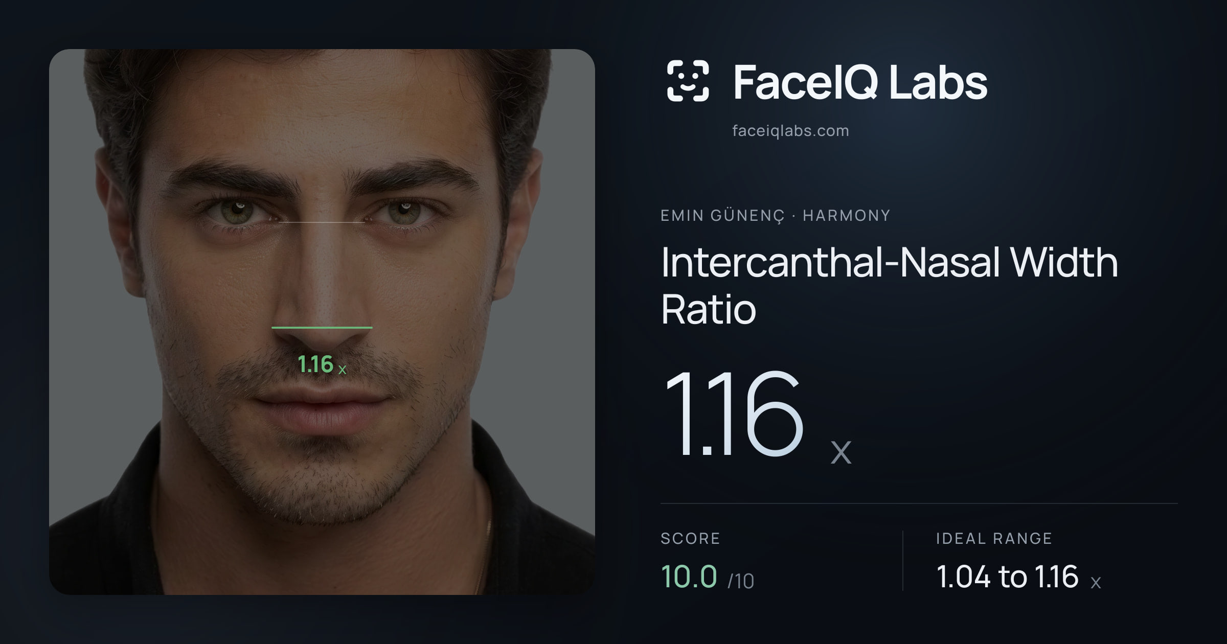 Emin Günenç Intercanthal-Nasal Width Ratio: 1.16x, drawn on the photo