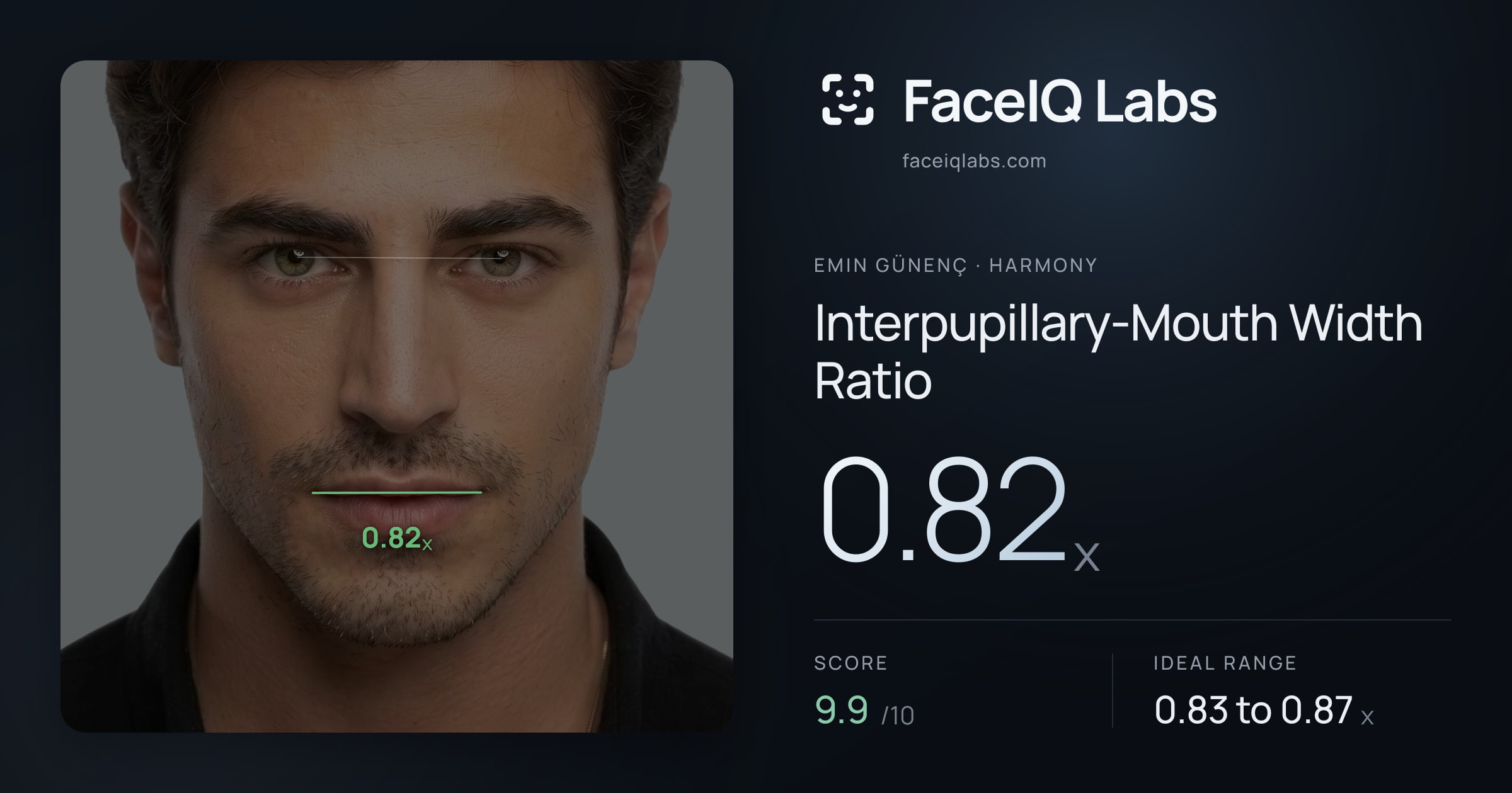 Emin Günenç Interpupillary-Mouth Width Ratio: 0.82x, drawn on the photo