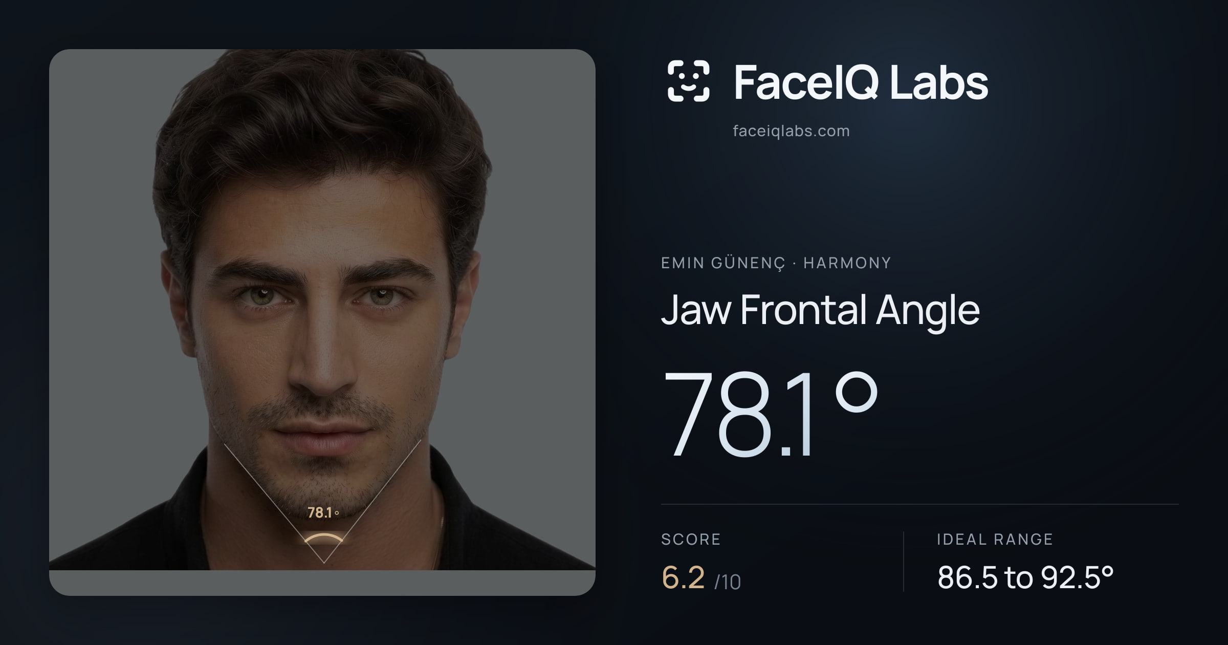 Emin Günenç Jaw Frontal Angle: 78.1°, drawn on the photo