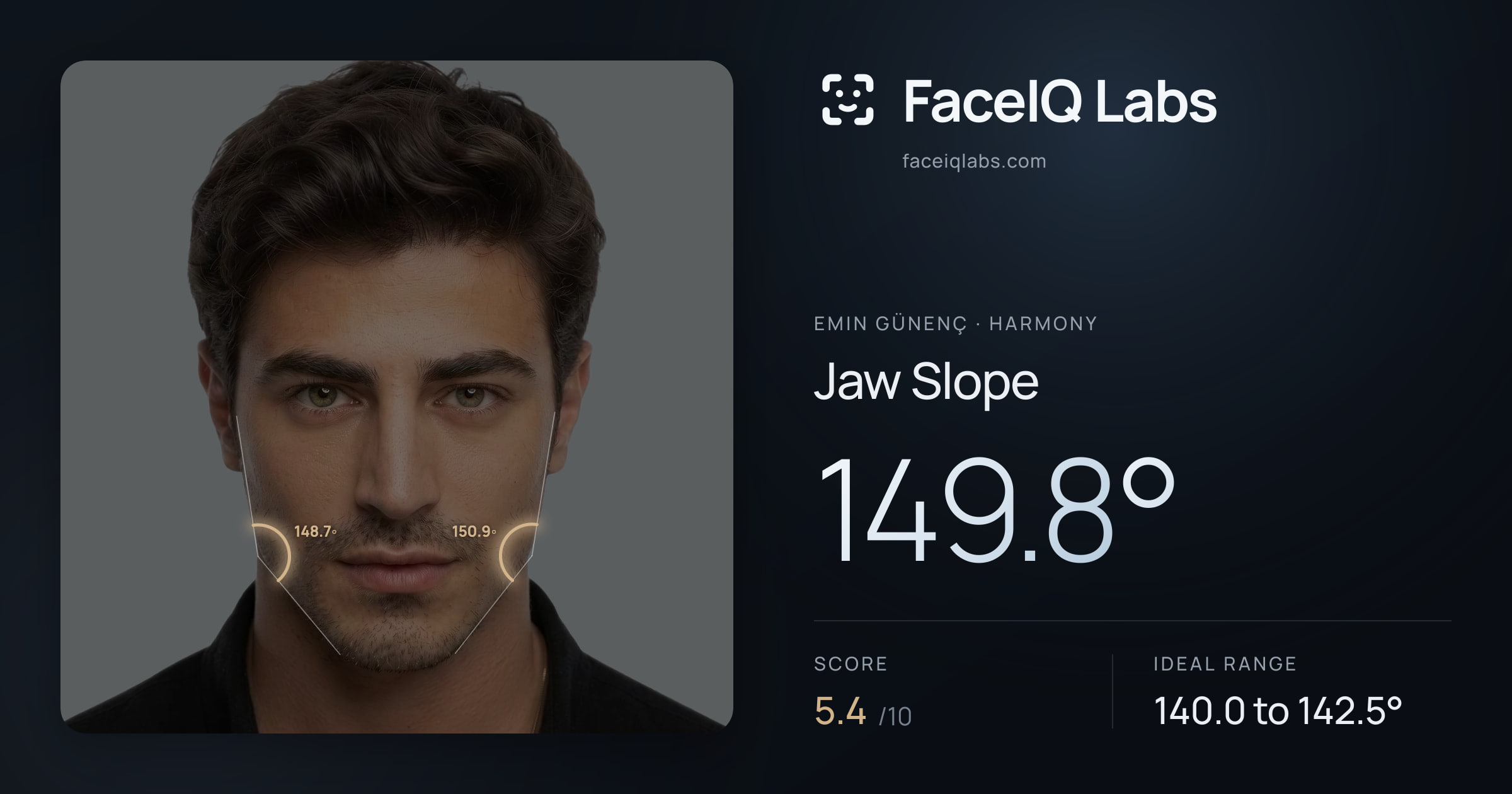 Emin Günenç Jaw Slope: 149.8°, drawn on the photo