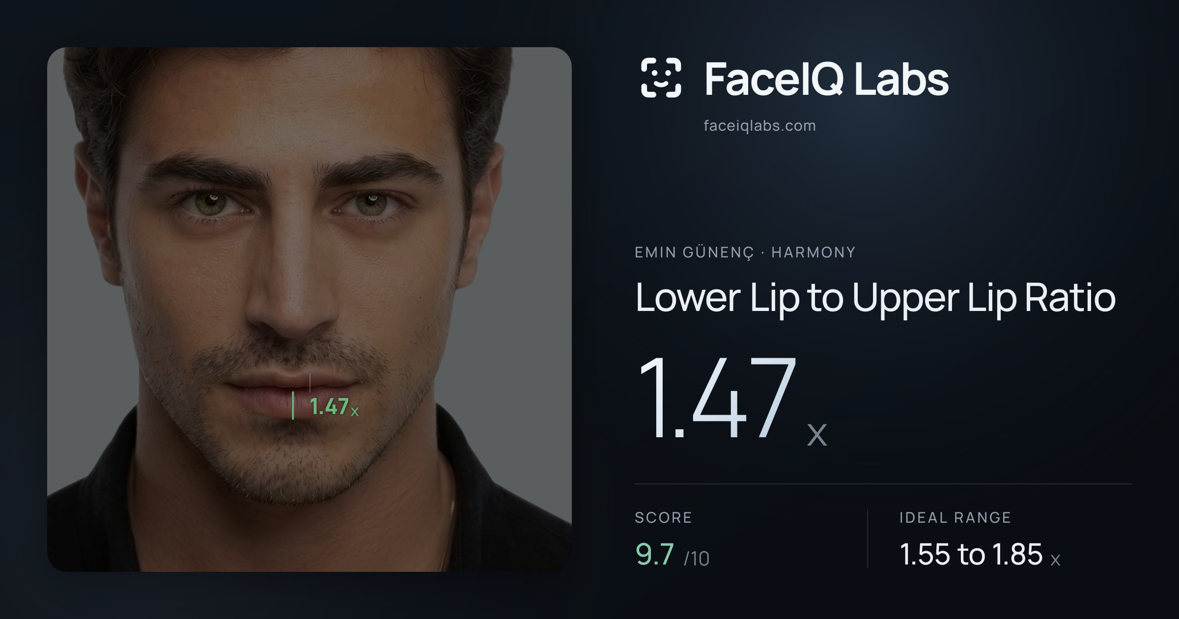 Emin Günenç Lower Lip to Upper Lip Ratio: 1.47x, drawn on the photo