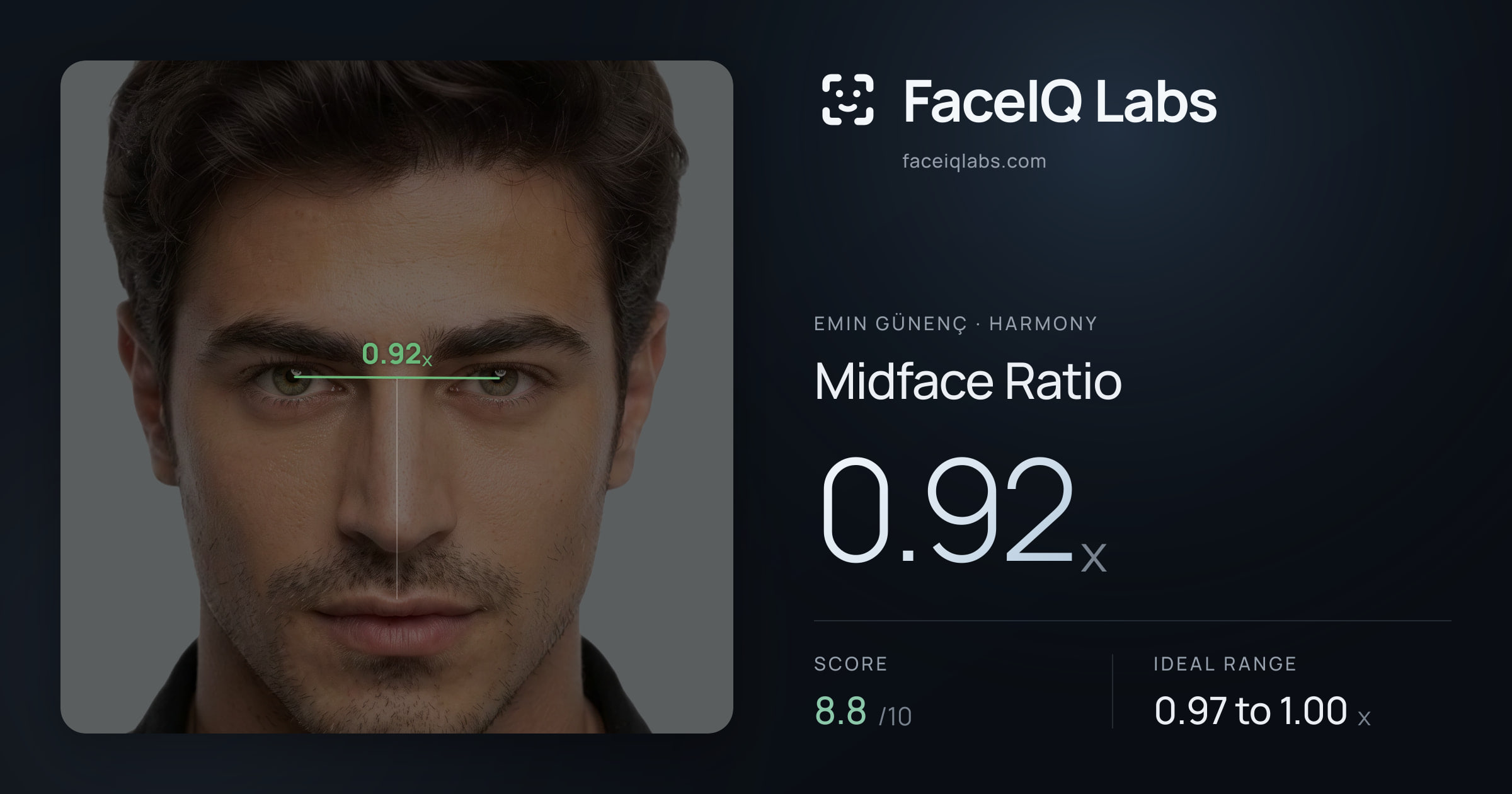 Emin Günenç Midface Ratio: 0.92x, drawn on the photo