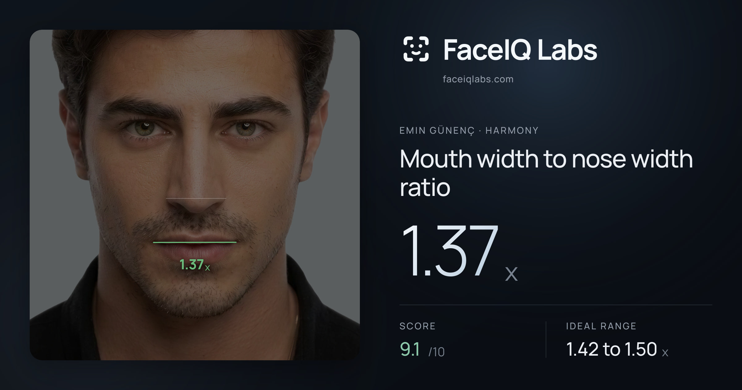 Emin Günenç Mouth width to nose width ratio: 1.37x, drawn on the photo