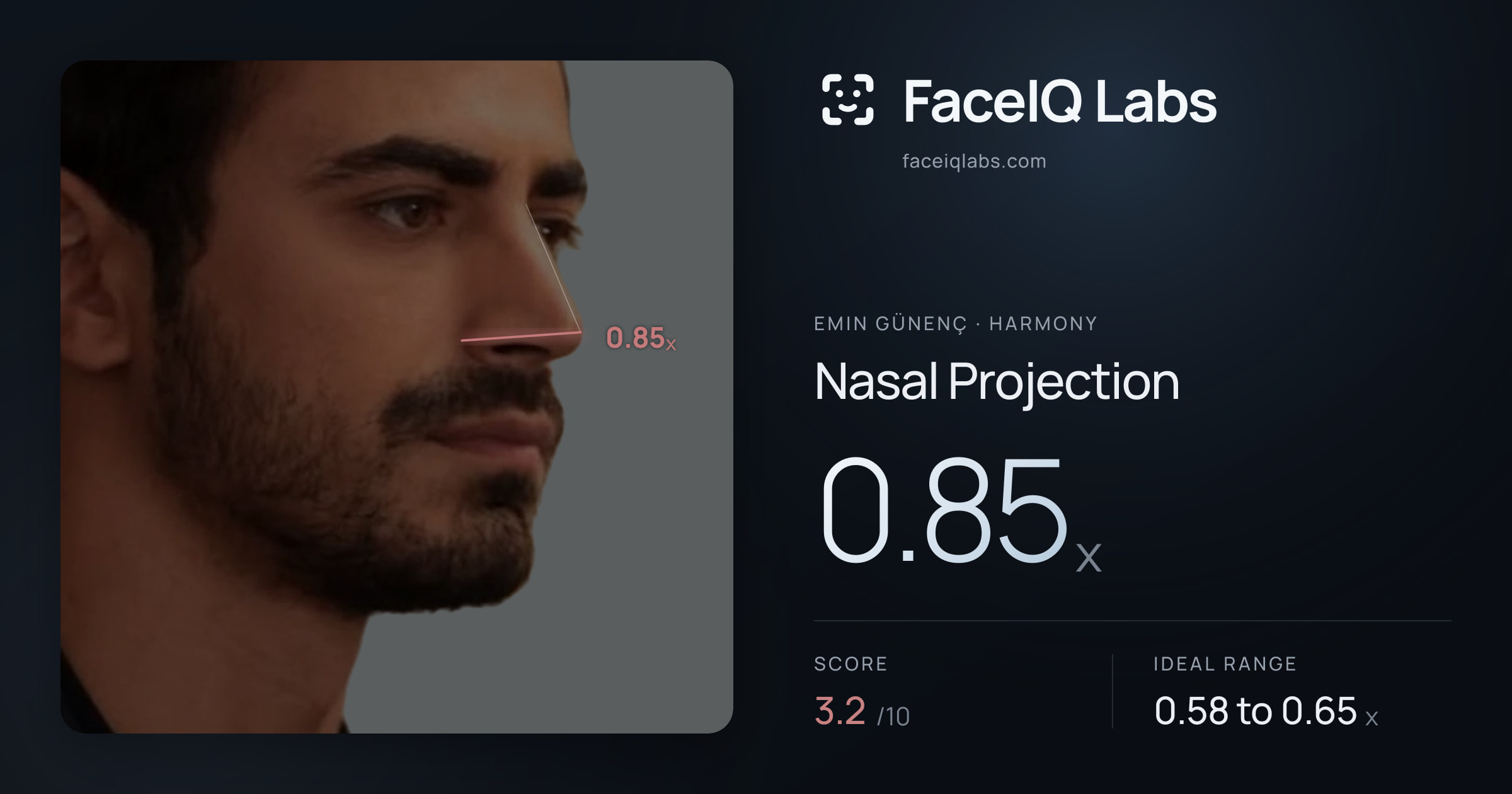 Emin Günenç Nasal Projection: 0.85x, drawn on the photo
