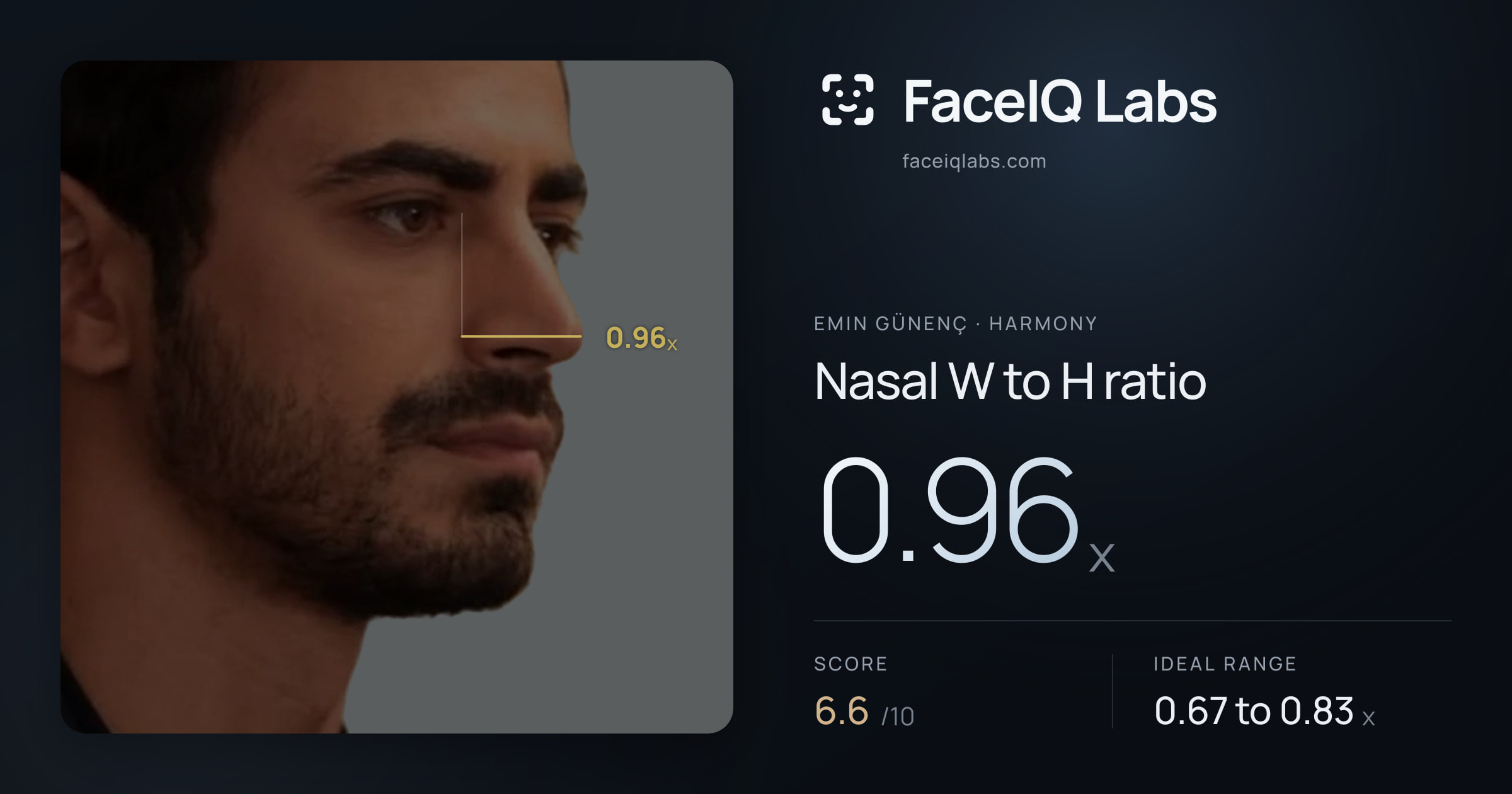 Emin Günenç Nasal W to H ratio: 0.96x, drawn on the photo