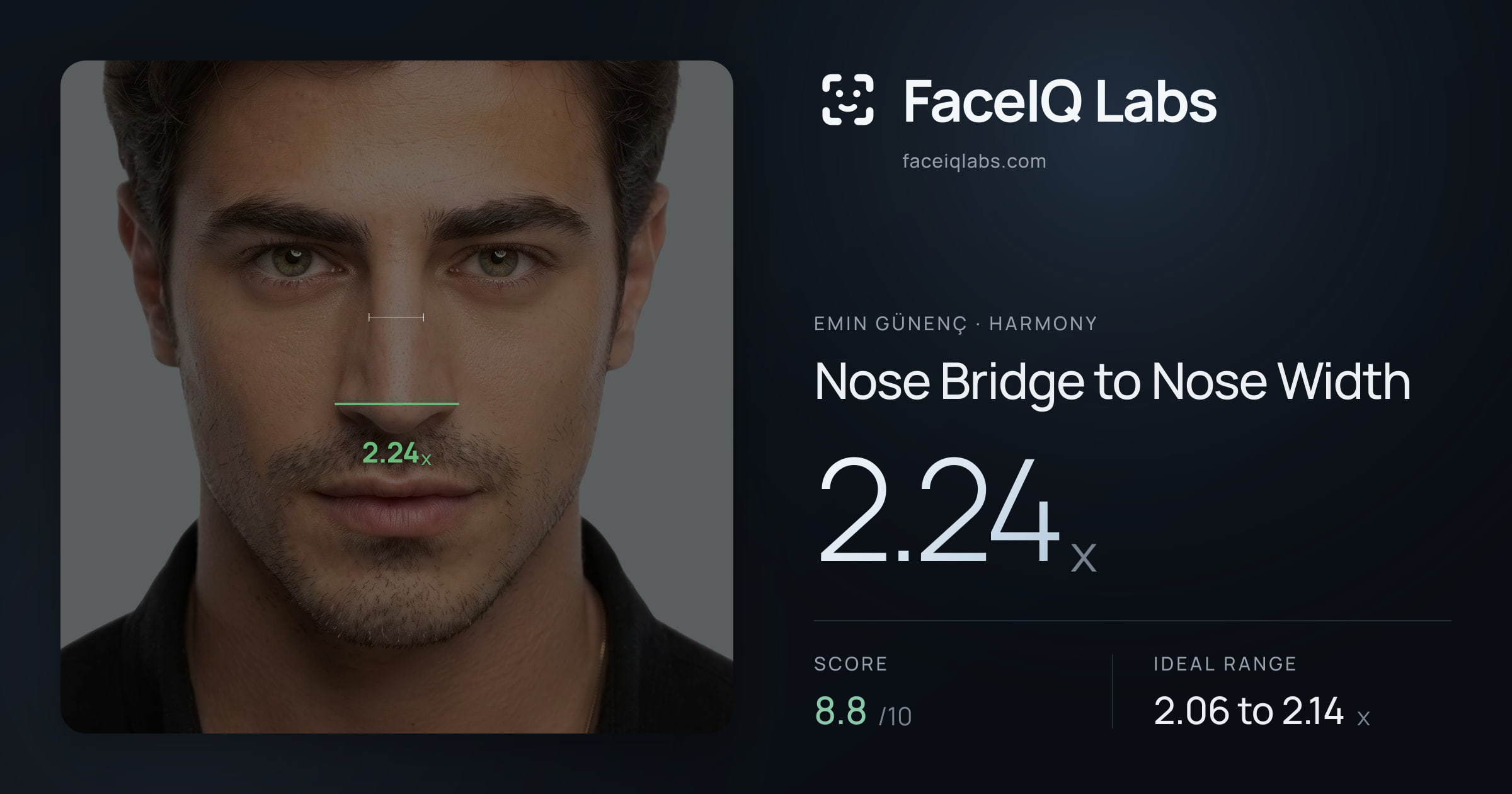 Emin Günenç Nose Bridge to Nose Width: 2.24x, drawn on the photo