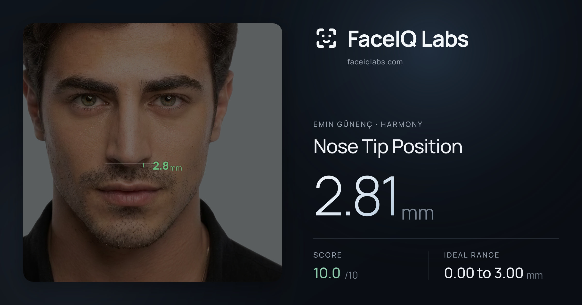 Emin Günenç Nose Tip Position: 2.81mm, drawn on the photo
