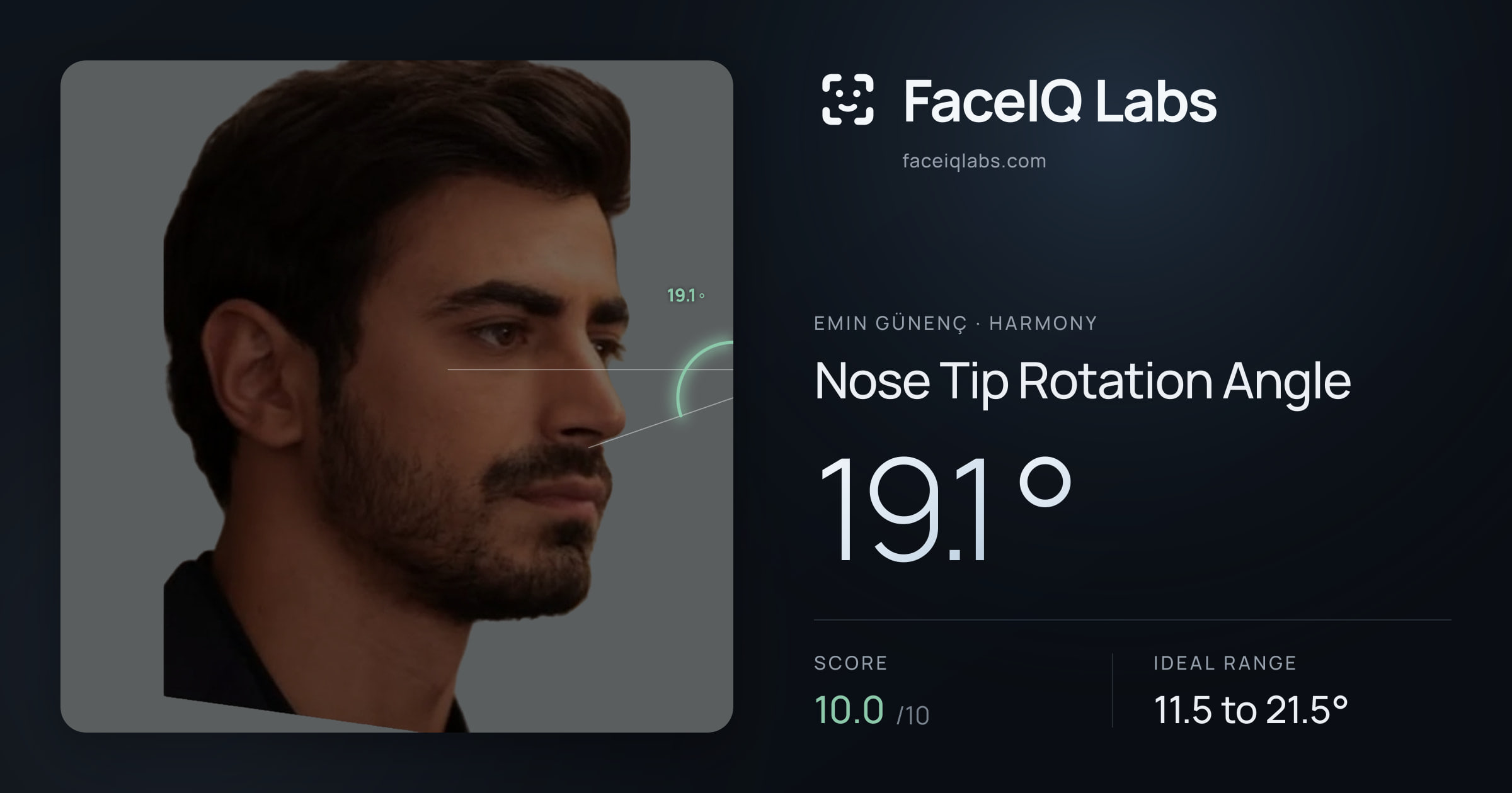 Emin Günenç Nose Tip Rotation Angle: 19.1°, drawn on the photo