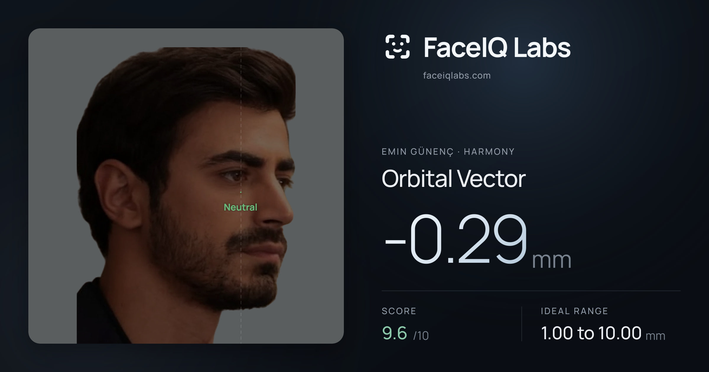 Emin Günenç Orbital Vector: -0.29mm, drawn on the photo