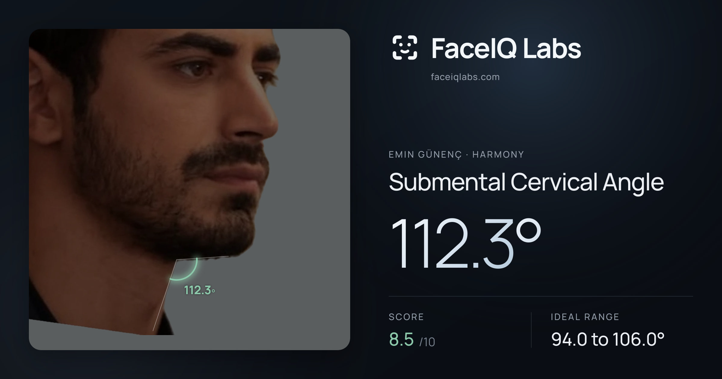 Emin Günenç Submental Cervical Angle: 112.3°, drawn on the photo
