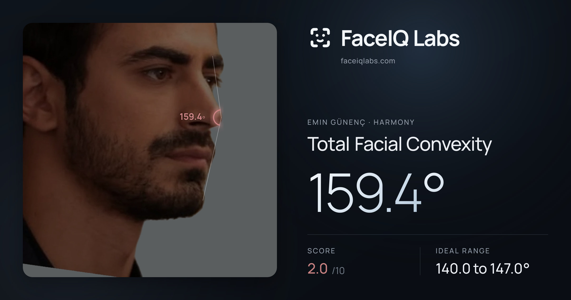 Emin Günenç Total Facial Convexity: 159.4°, drawn on the photo
