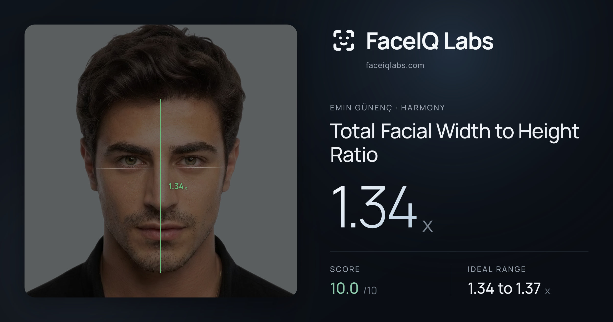 Emin Günenç Total Facial Width to Height Ratio: 1.34x, drawn on the photo