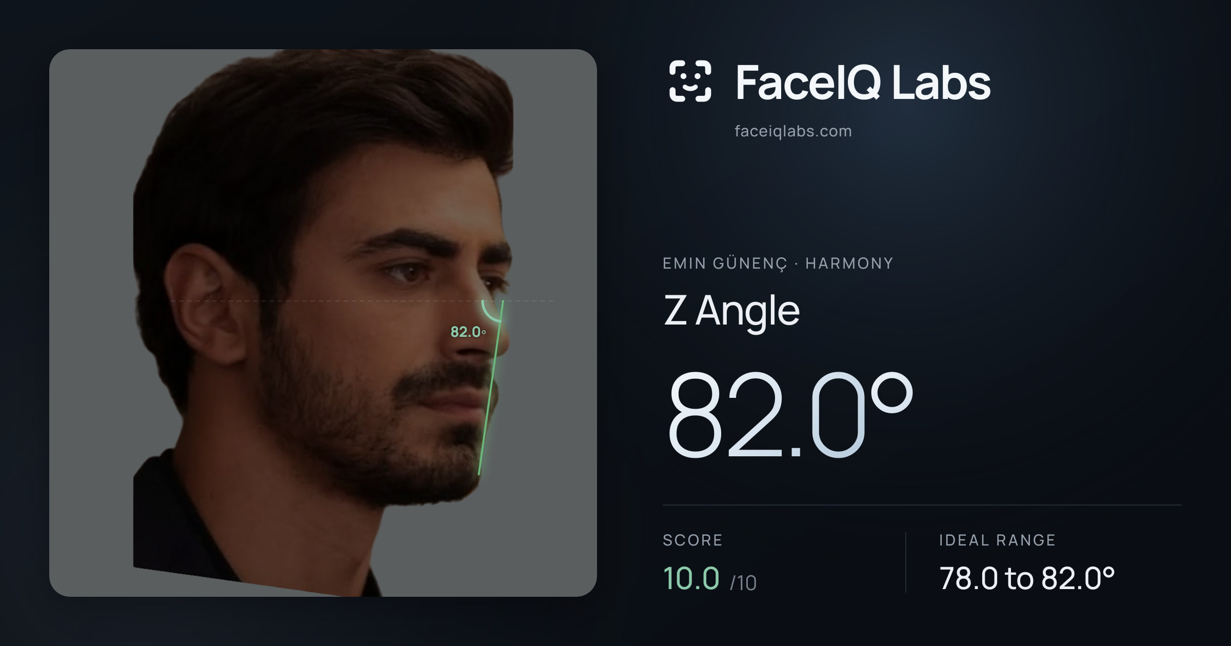 Emin Günenç Z Angle: 82.0°, drawn on the photo