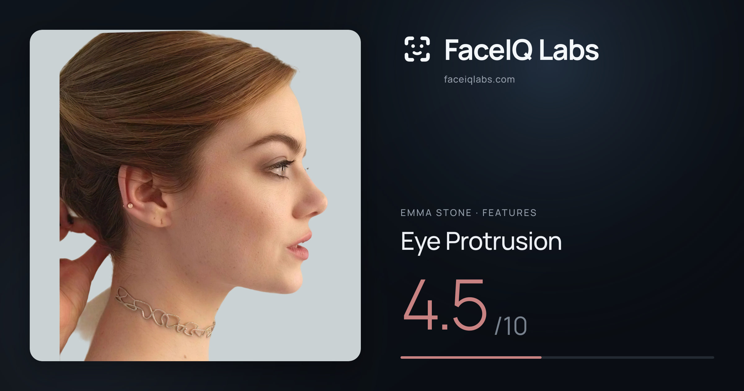 Emma Stone Eye Protrusion: 4.5/10, drawn on the photo