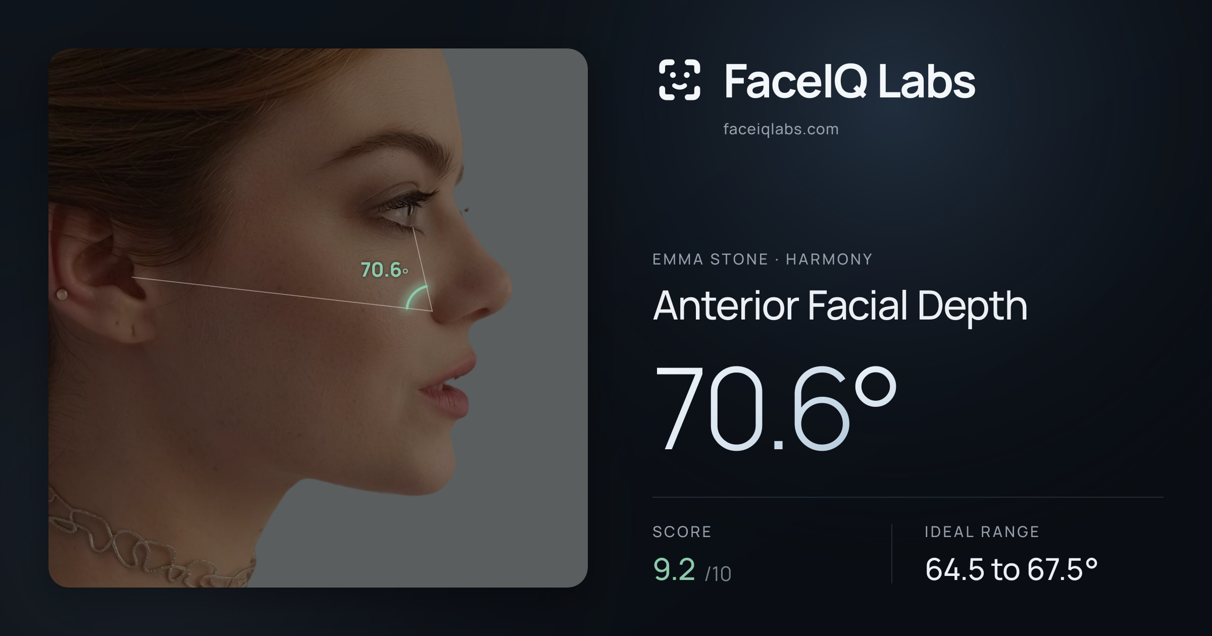Emma Stone Anterior Facial Depth: 70.6°, drawn on the photo