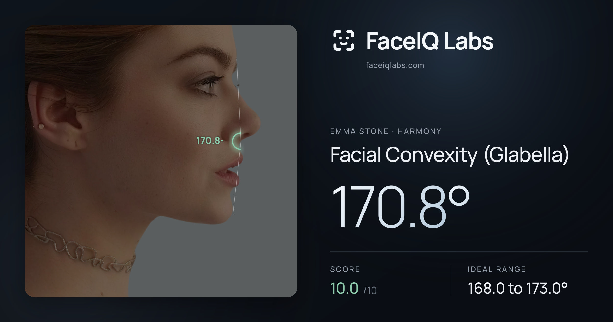 Emma Stone Facial Convexity (Glabella): 170.8°, drawn on the photo