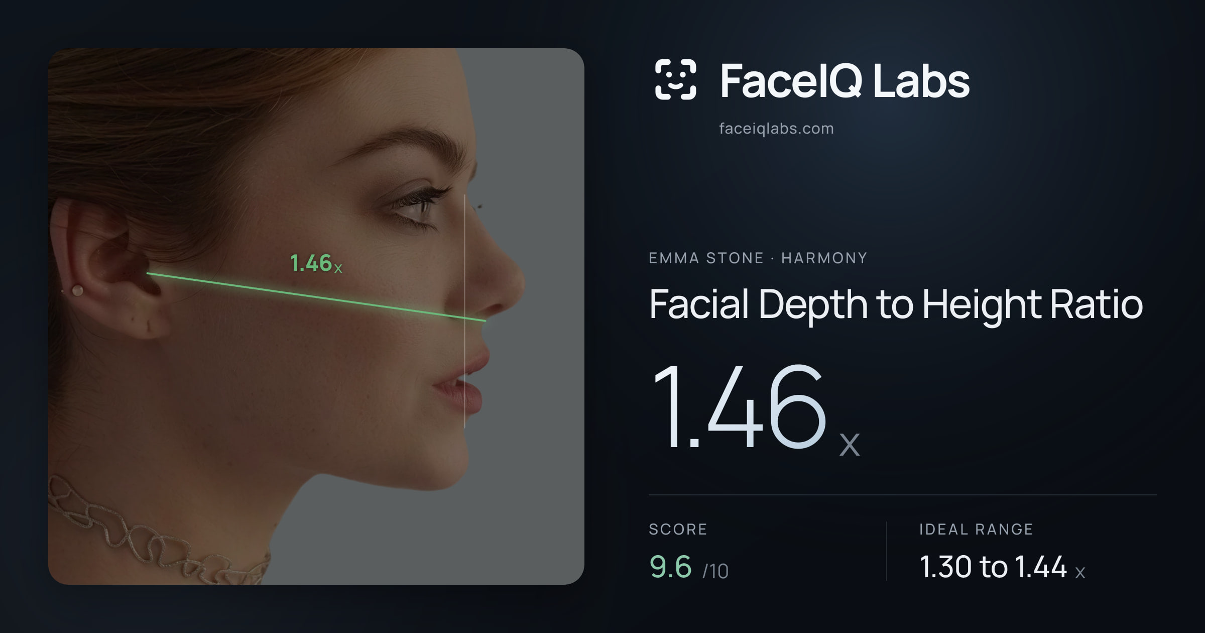 Emma Stone Facial Depth to Height Ratio: 1.46x, drawn on the photo