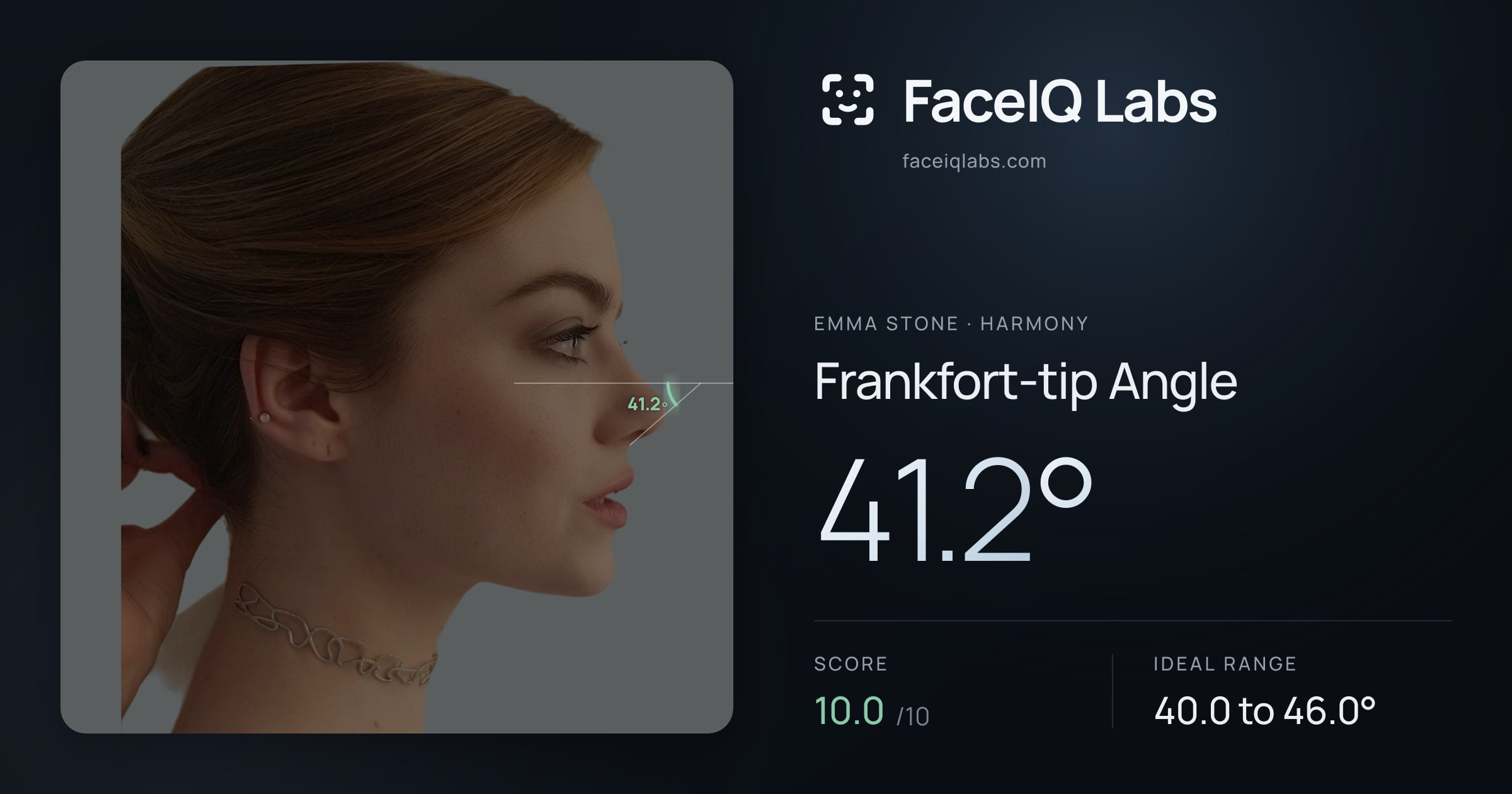 Emma Stone Frankfort-tip Angle: 41.2°, drawn on the photo