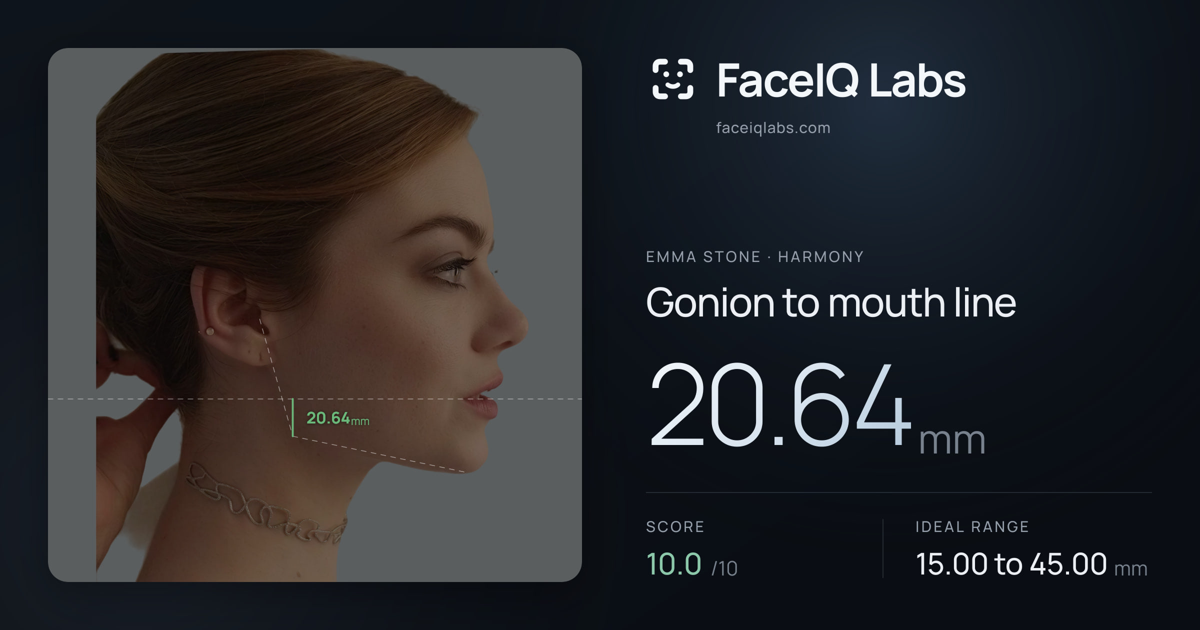 Emma Stone Gonion to mouth line: 20.64mm, drawn on the photo