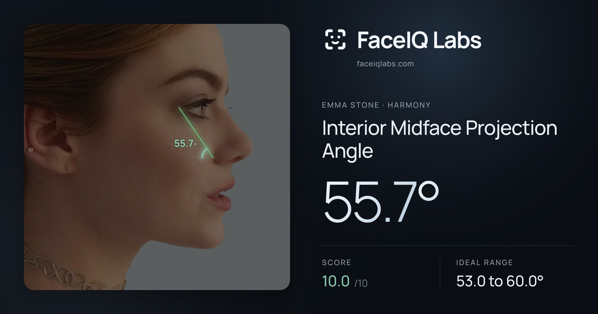 Emma Stone Interior Midface Projection Angle: 55.7°, drawn on the photo