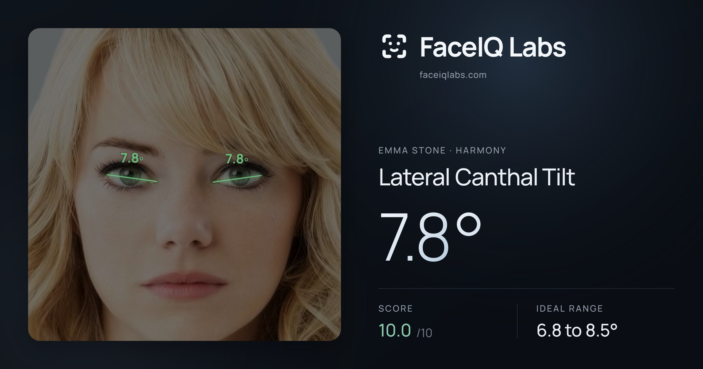 Emma Stone Lateral Canthal Tilt: 7.8°, drawn on the photo