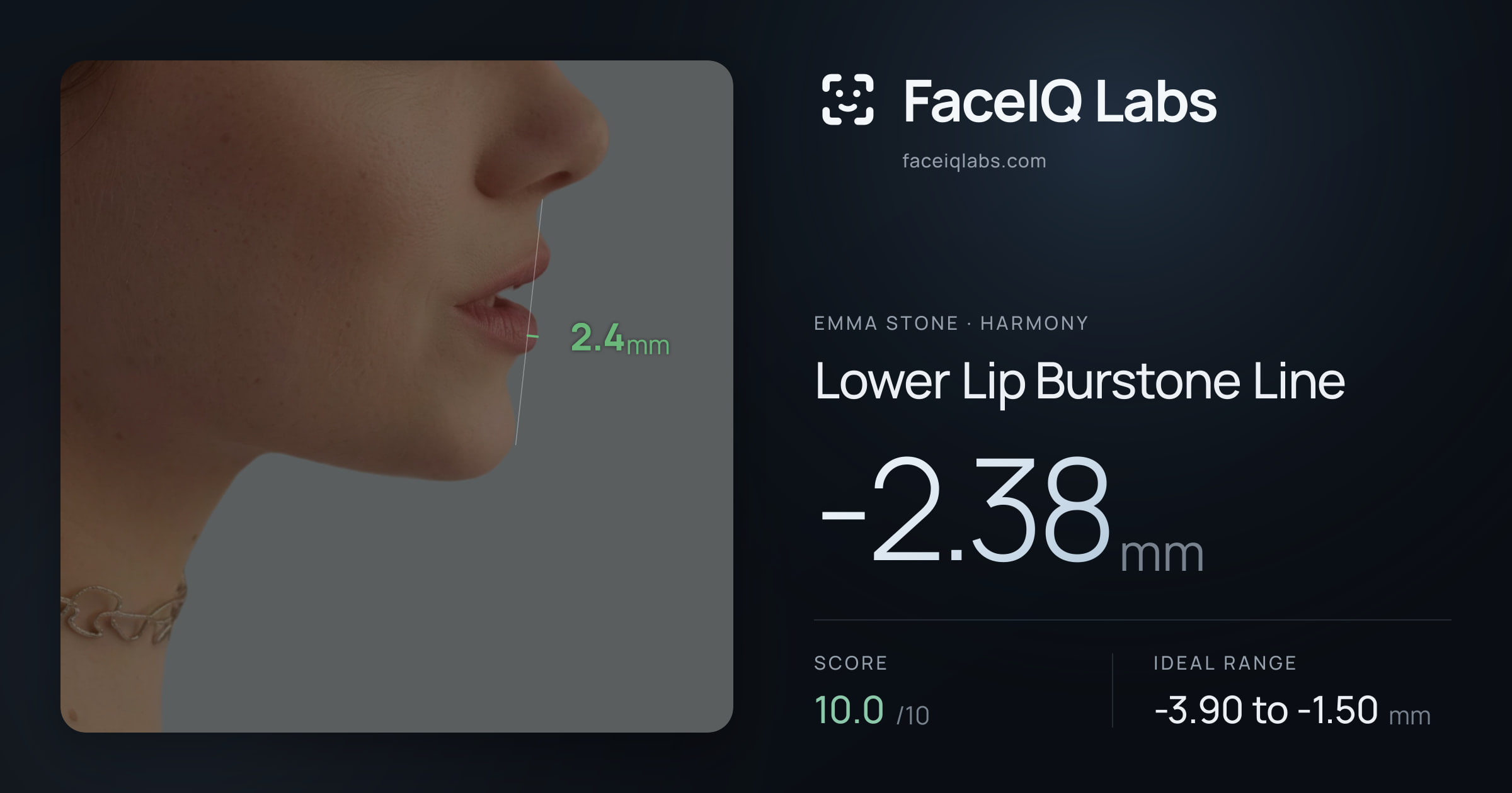 Emma Stone Lower Lip Burstone Line: -2.38mm, drawn on the photo