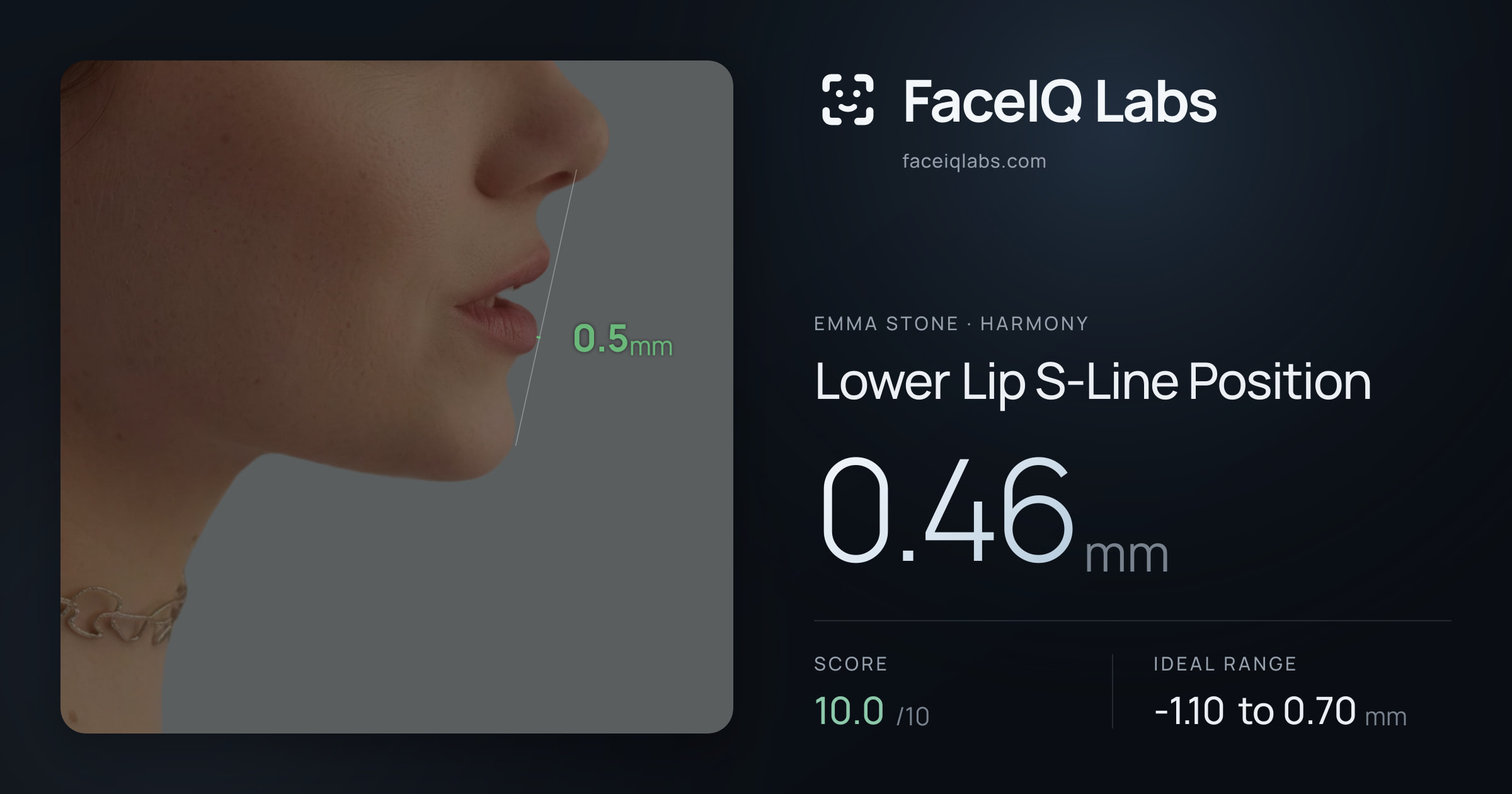 Emma Stone Lower Lip S-Line Position: 0.46mm, drawn on the photo