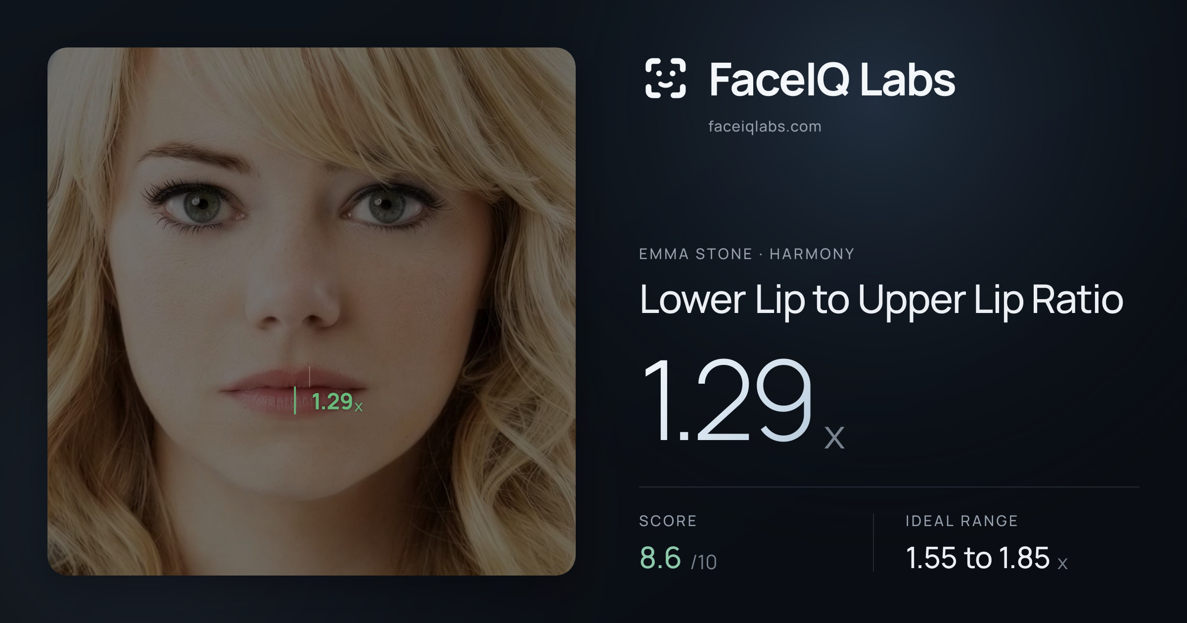 Emma Stone Lower Lip to Upper Lip Ratio: 1.29x, drawn on the photo