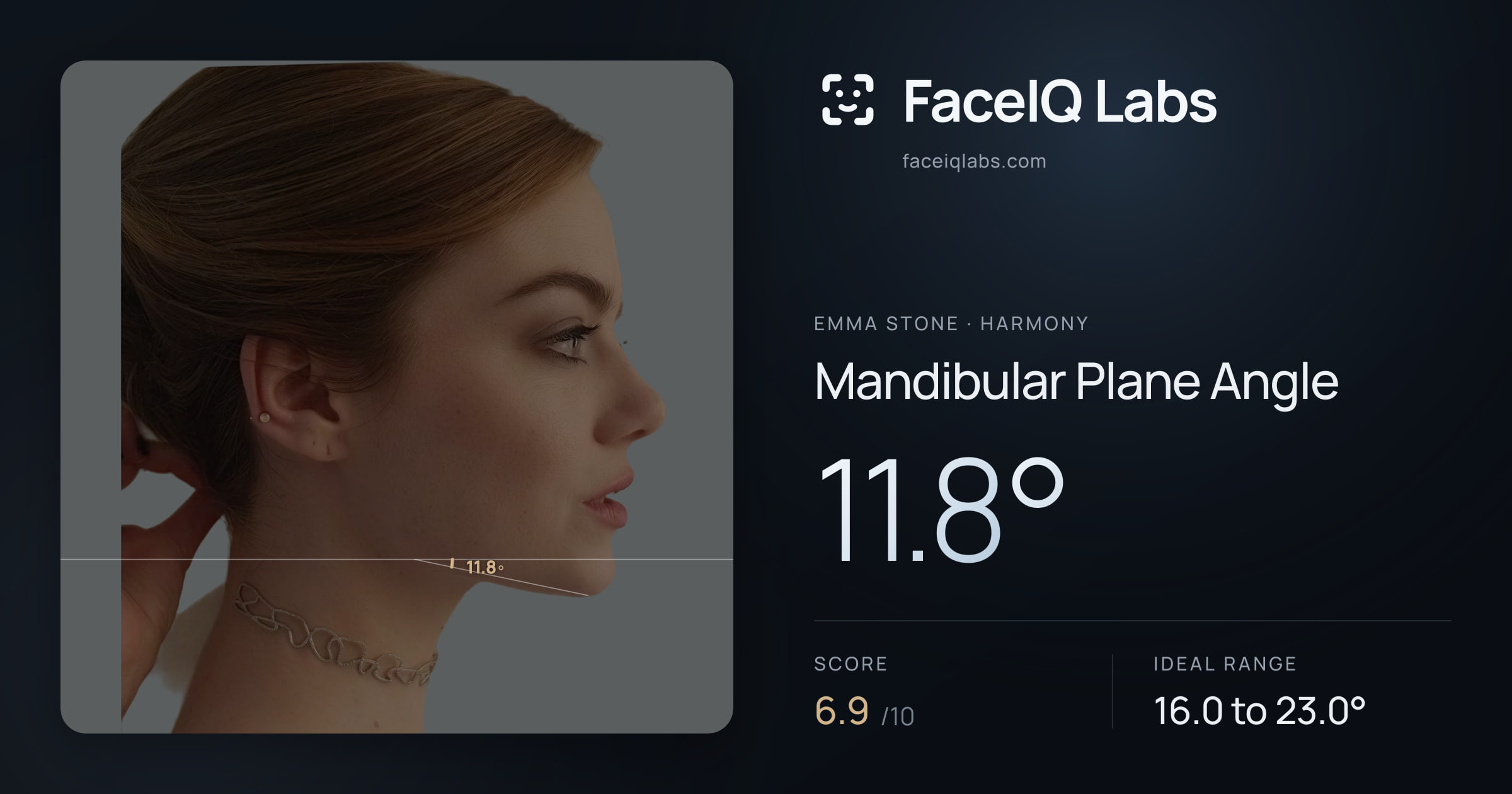 Emma Stone Mandibular Plane Angle: 11.8°, drawn on the photo