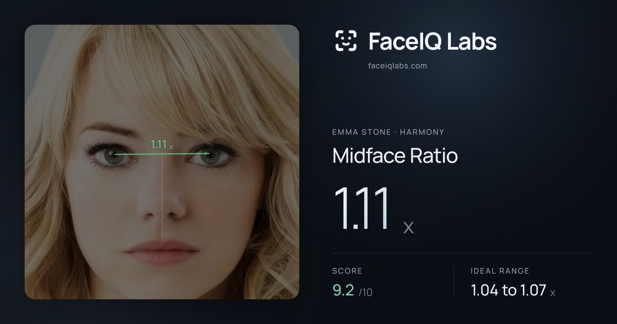 Emma Stone Midface Ratio: 1.11x, drawn on the photo
