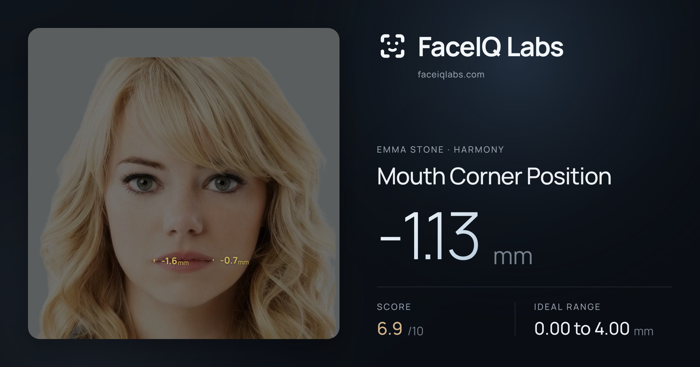 Emma Stone Mouth Corner Position: -1.13mm, drawn on the photo