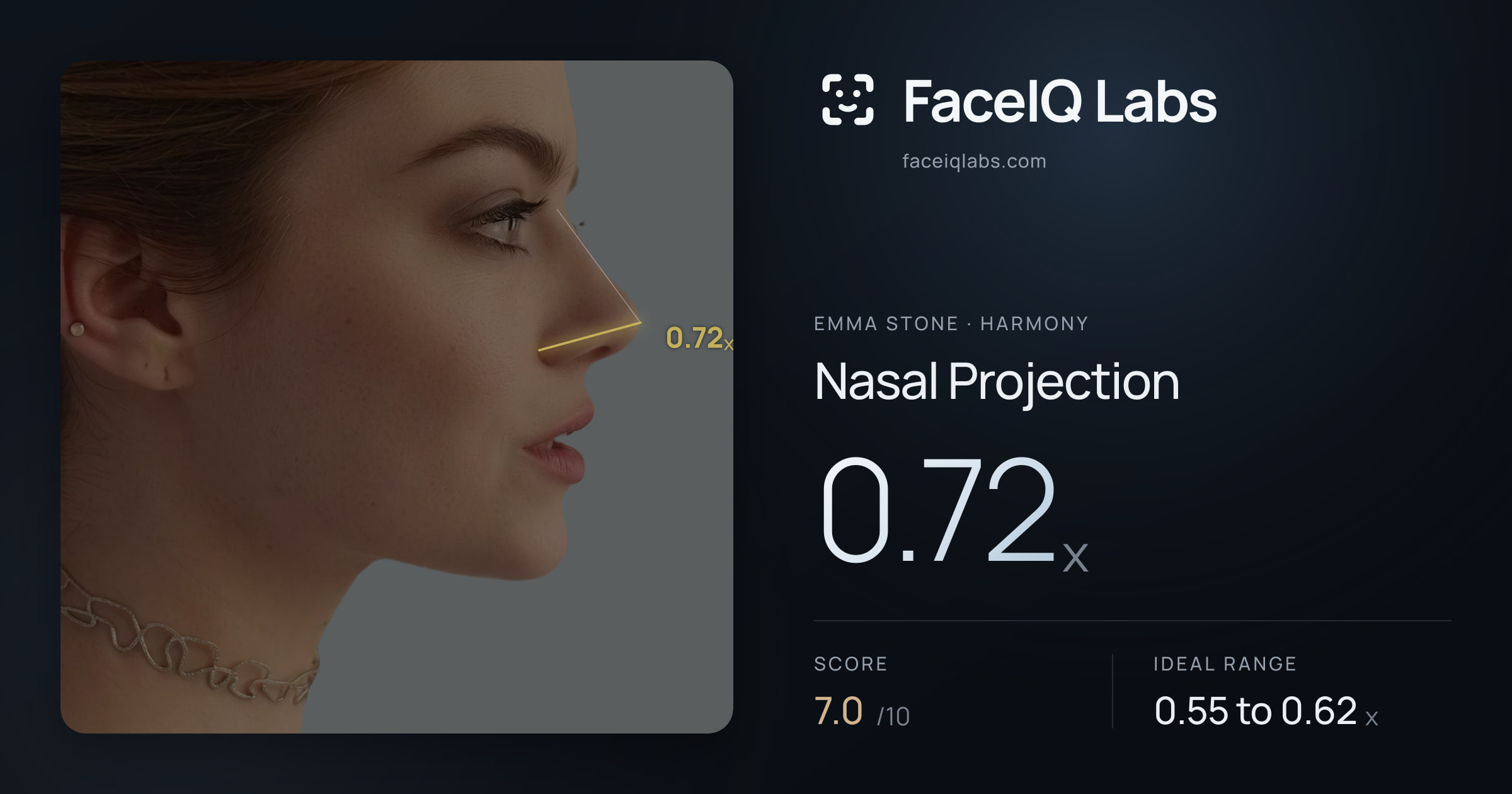 Emma Stone Nasal Projection: 0.72x, drawn on the photo