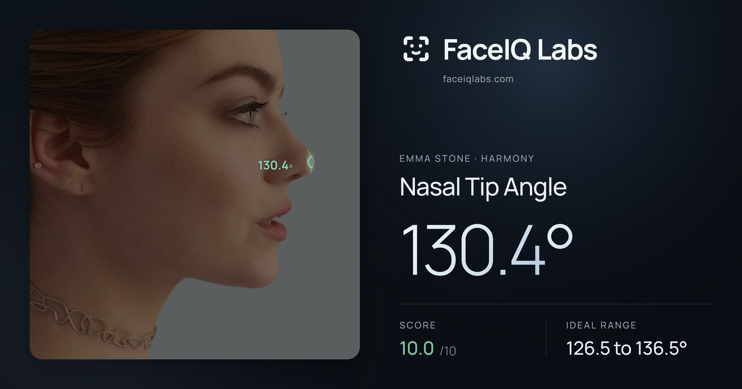 Emma Stone Nasal Tip Angle: 130.4°, drawn on the photo