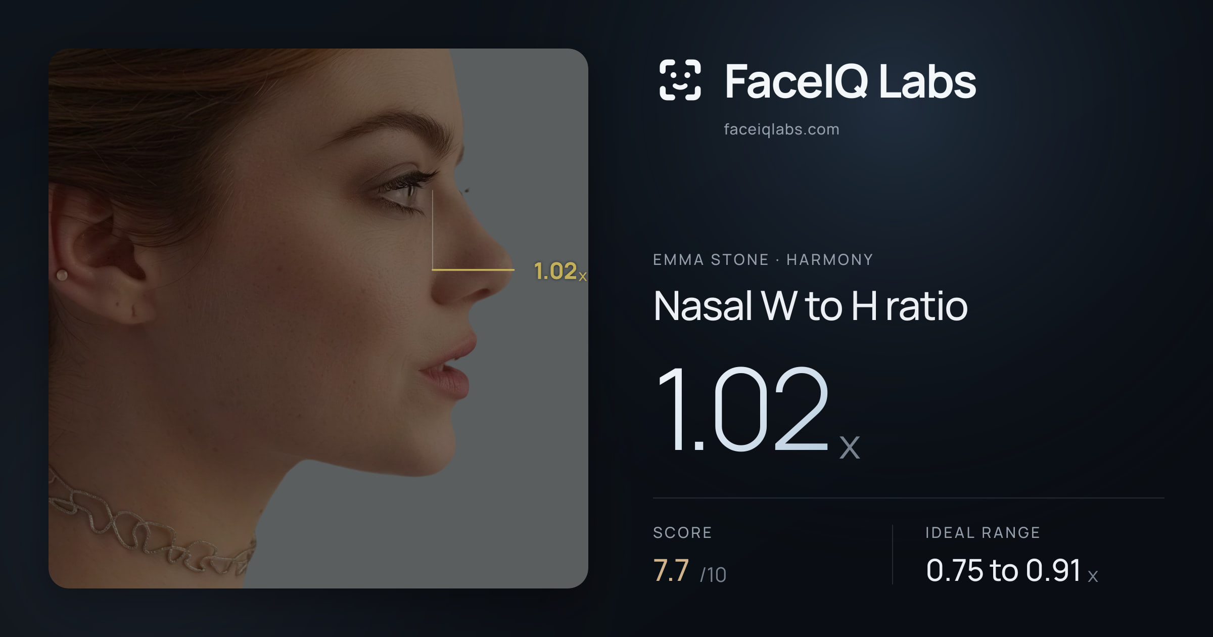 Emma Stone Nasal W to H ratio: 1.02x, drawn on the photo