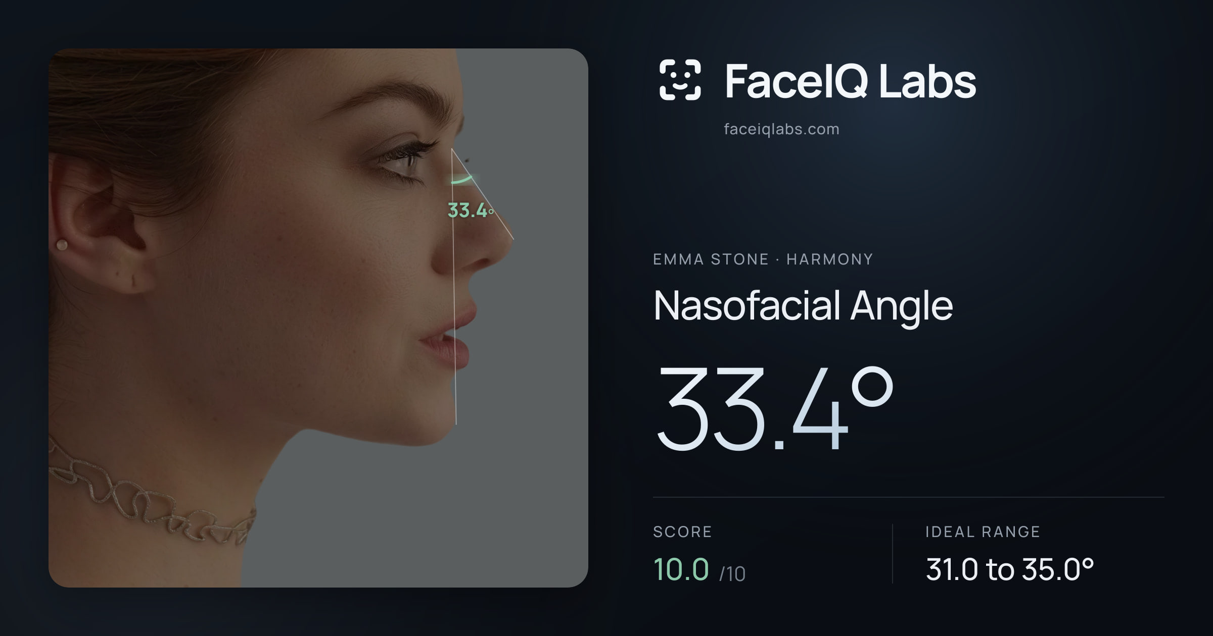 Emma Stone Nasofacial Angle: 33.4°, drawn on the photo