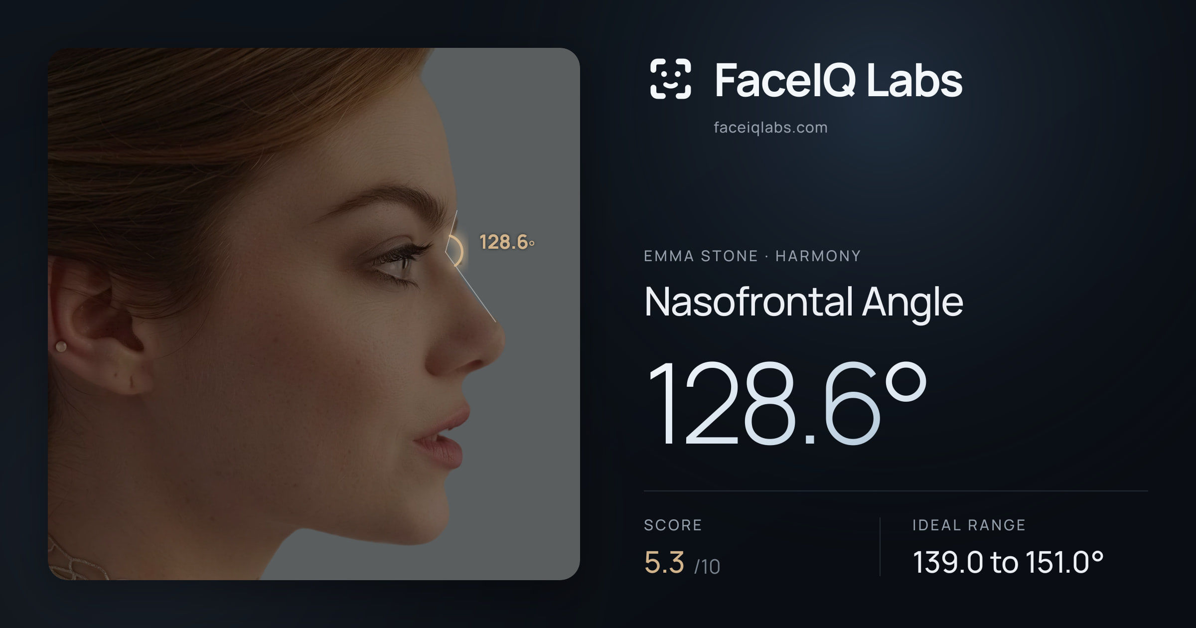 Emma Stone Nasofrontal Angle: 128.6°, drawn on the photo