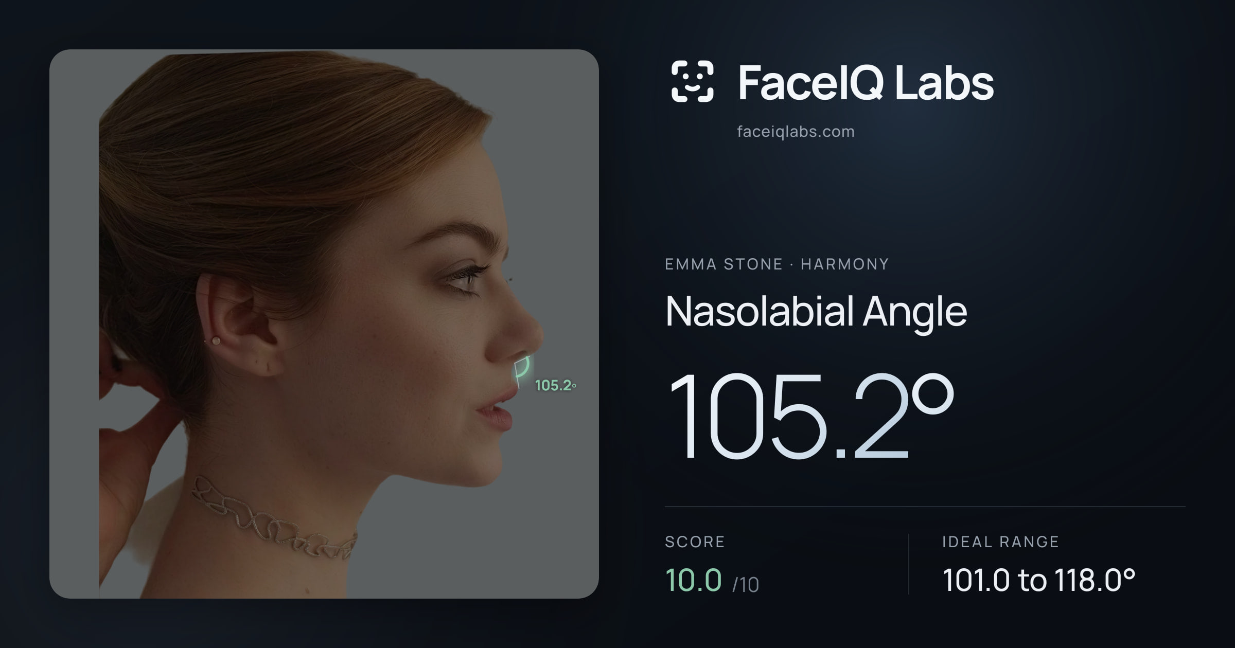 Emma Stone Nasolabial Angle: 105.2°, drawn on the photo