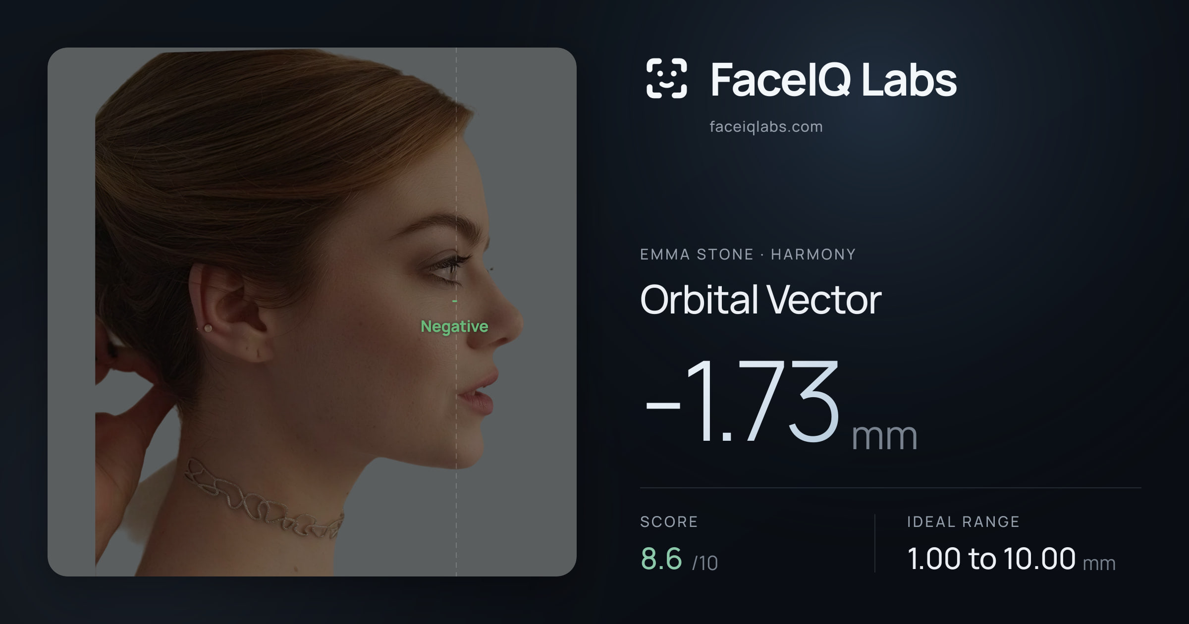 Emma Stone Orbital Vector: -1.73mm, drawn on the photo