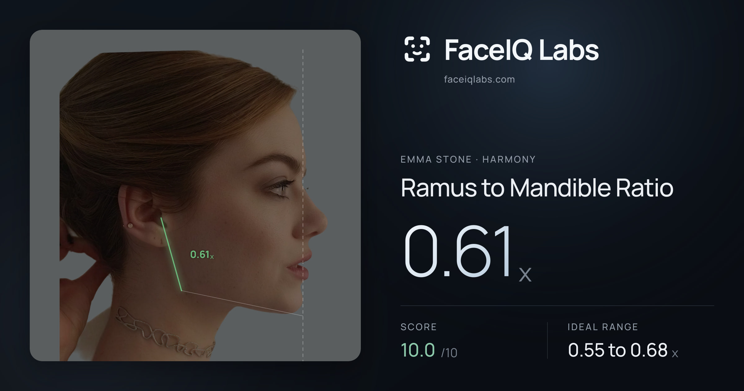 Emma Stone Ramus to Mandible Ratio: 0.61x, drawn on the photo