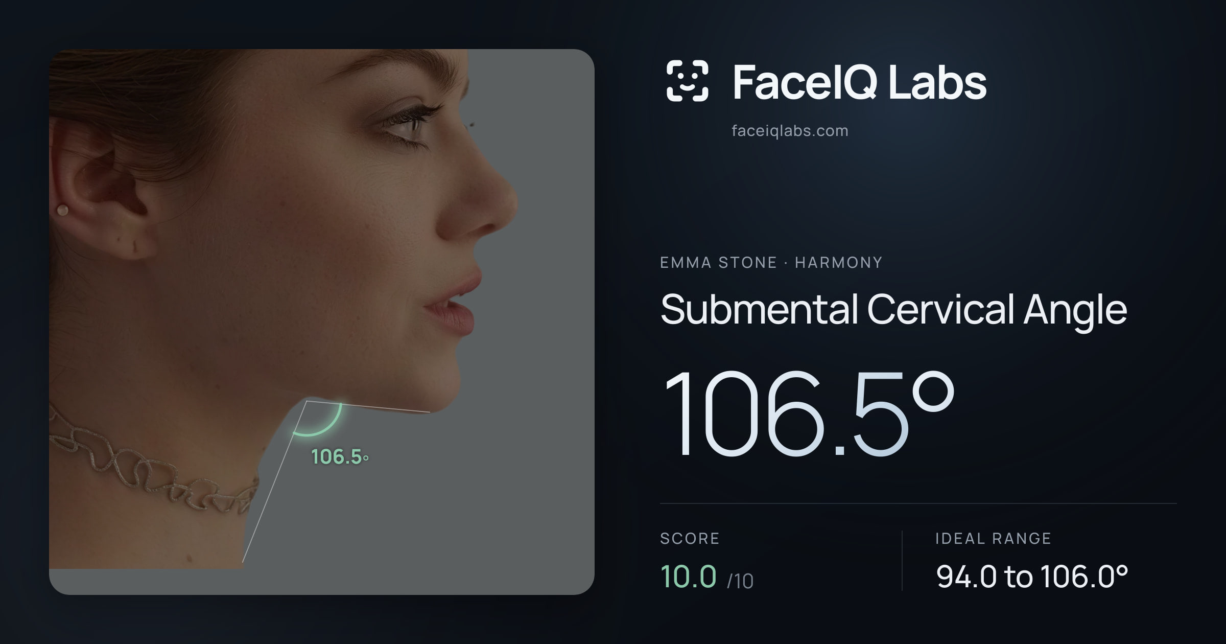 Emma Stone Submental Cervical Angle: 106.5°, drawn on the photo