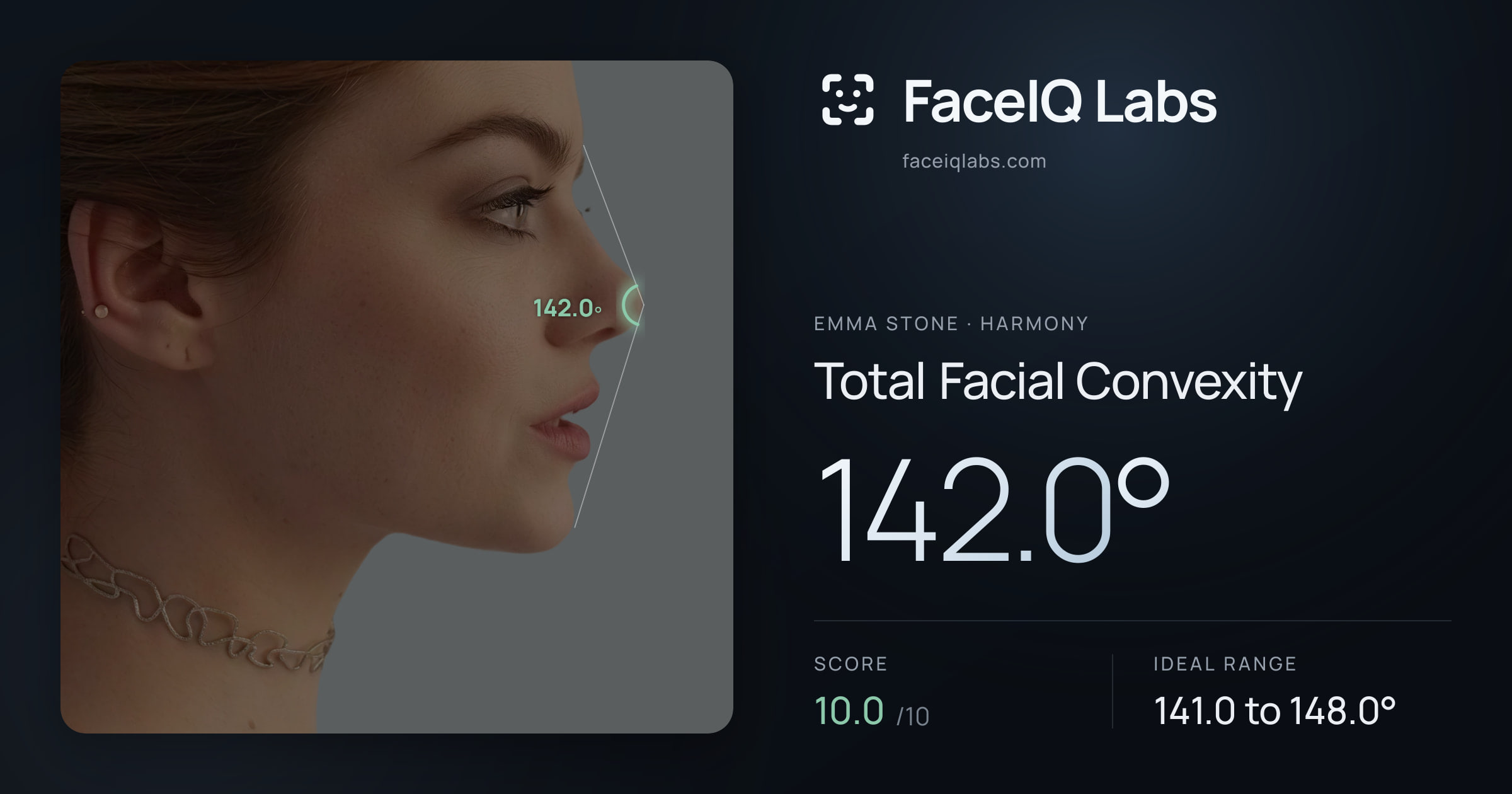 Emma Stone Total Facial Convexity: 142.0°, drawn on the photo