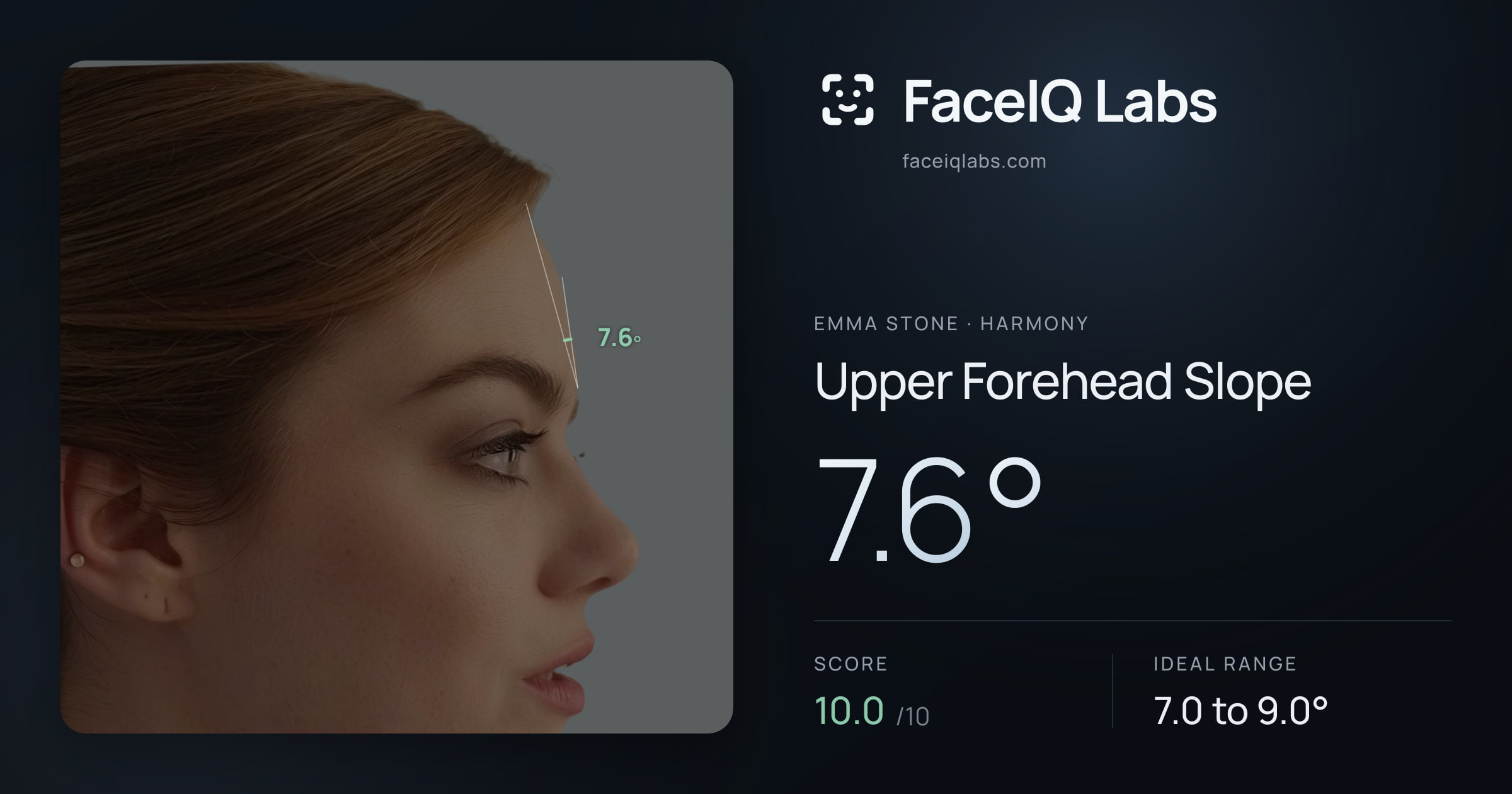 Emma Stone Upper Forehead Slope: 7.6°, drawn on the photo