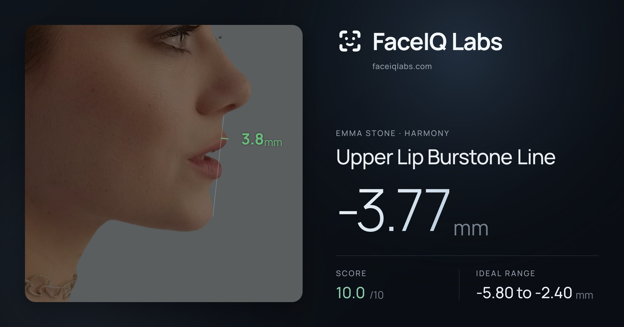 Emma Stone Upper Lip Burstone Line: -3.77mm, drawn on the photo