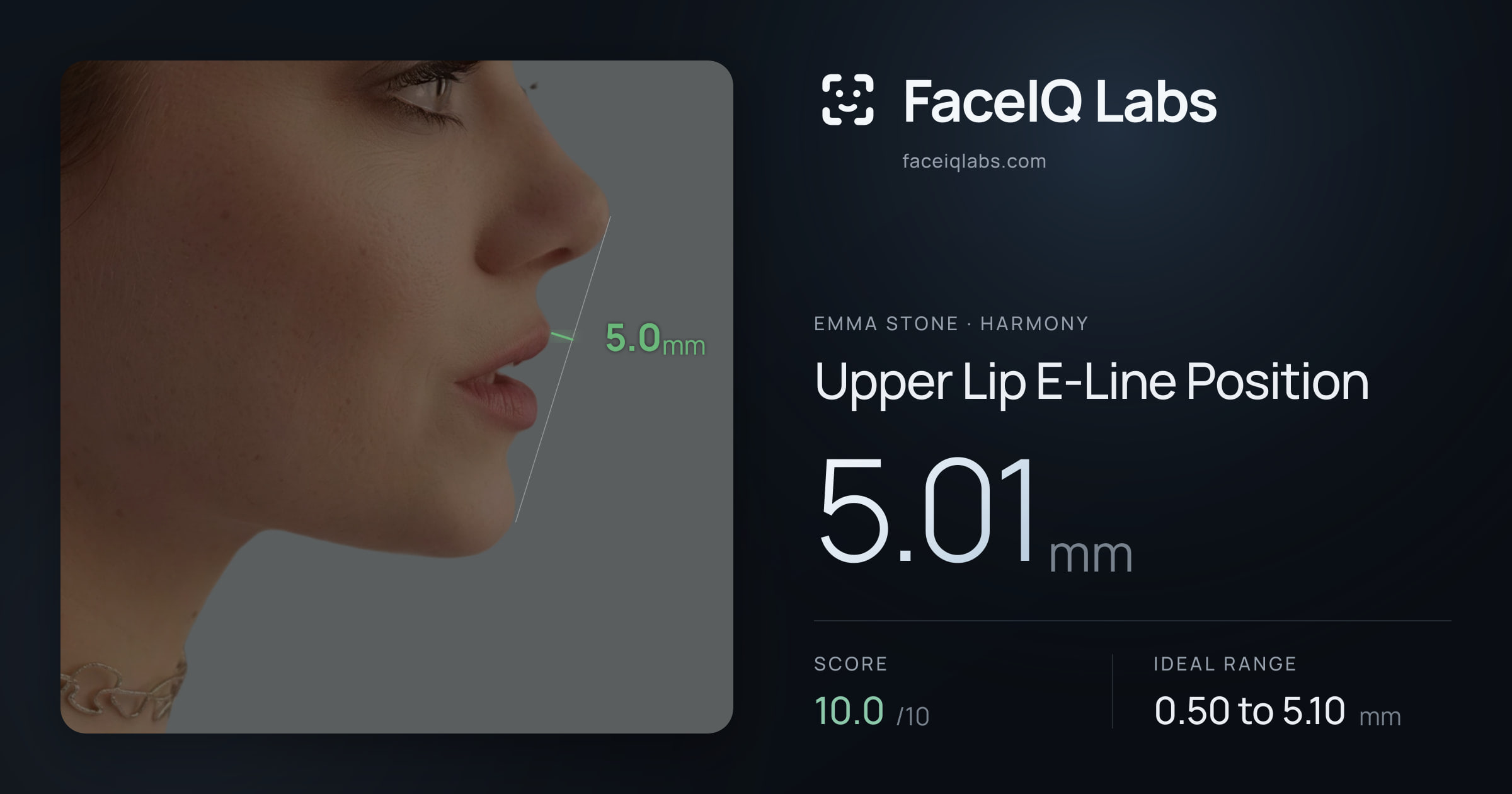 Emma Stone Upper Lip E-Line Position: 5.01mm, drawn on the photo