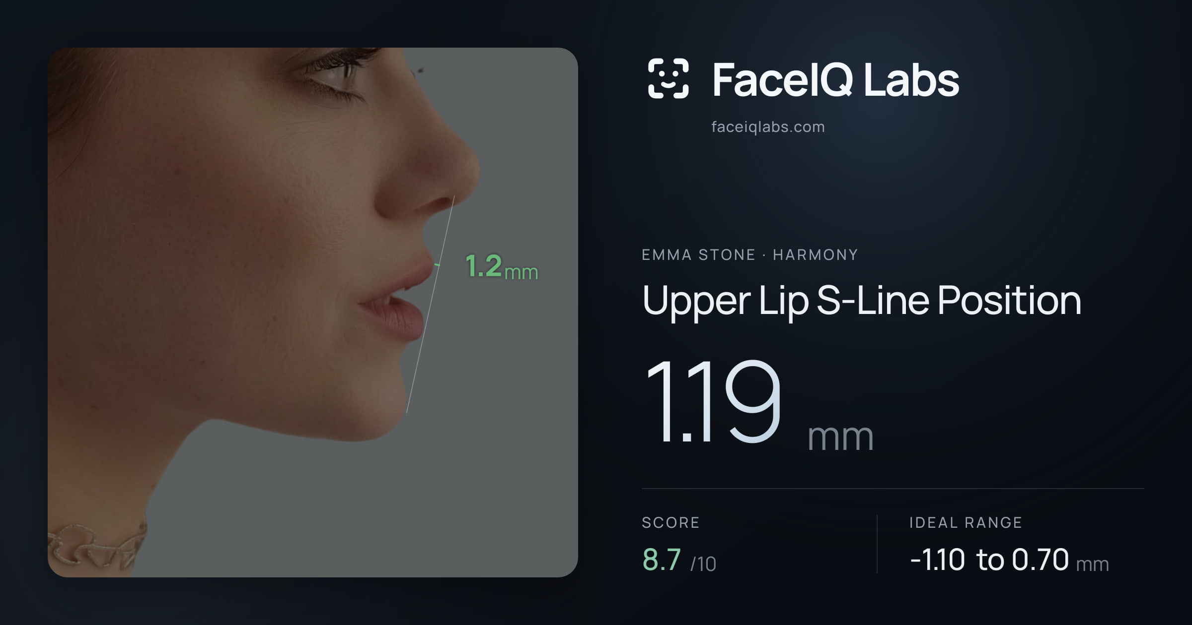 Emma Stone Upper Lip S-Line Position: 1.19mm, drawn on the photo