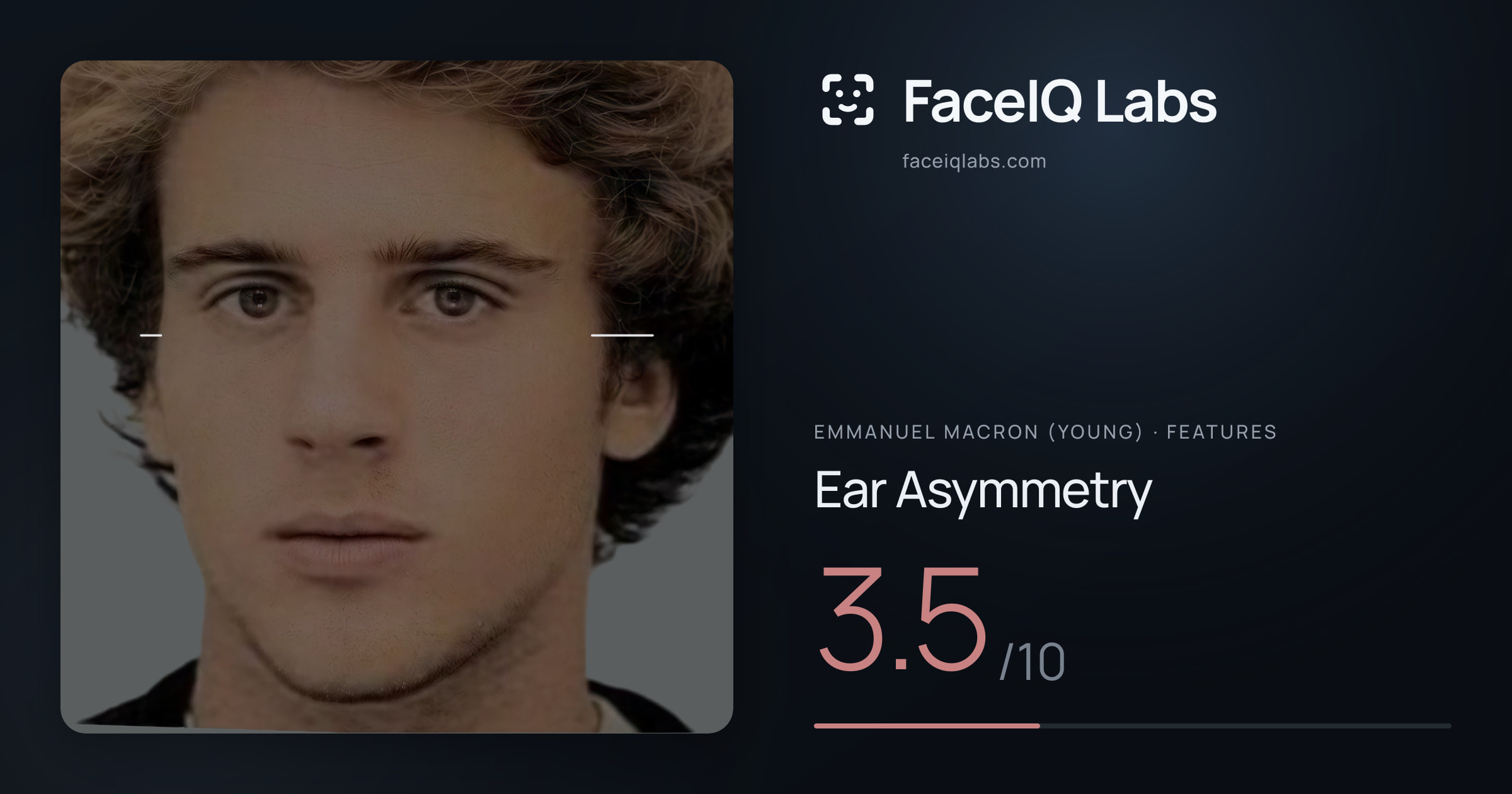 Emmanuel Macron (Young) Ear Asymmetry: 3.5/10, drawn on the photo