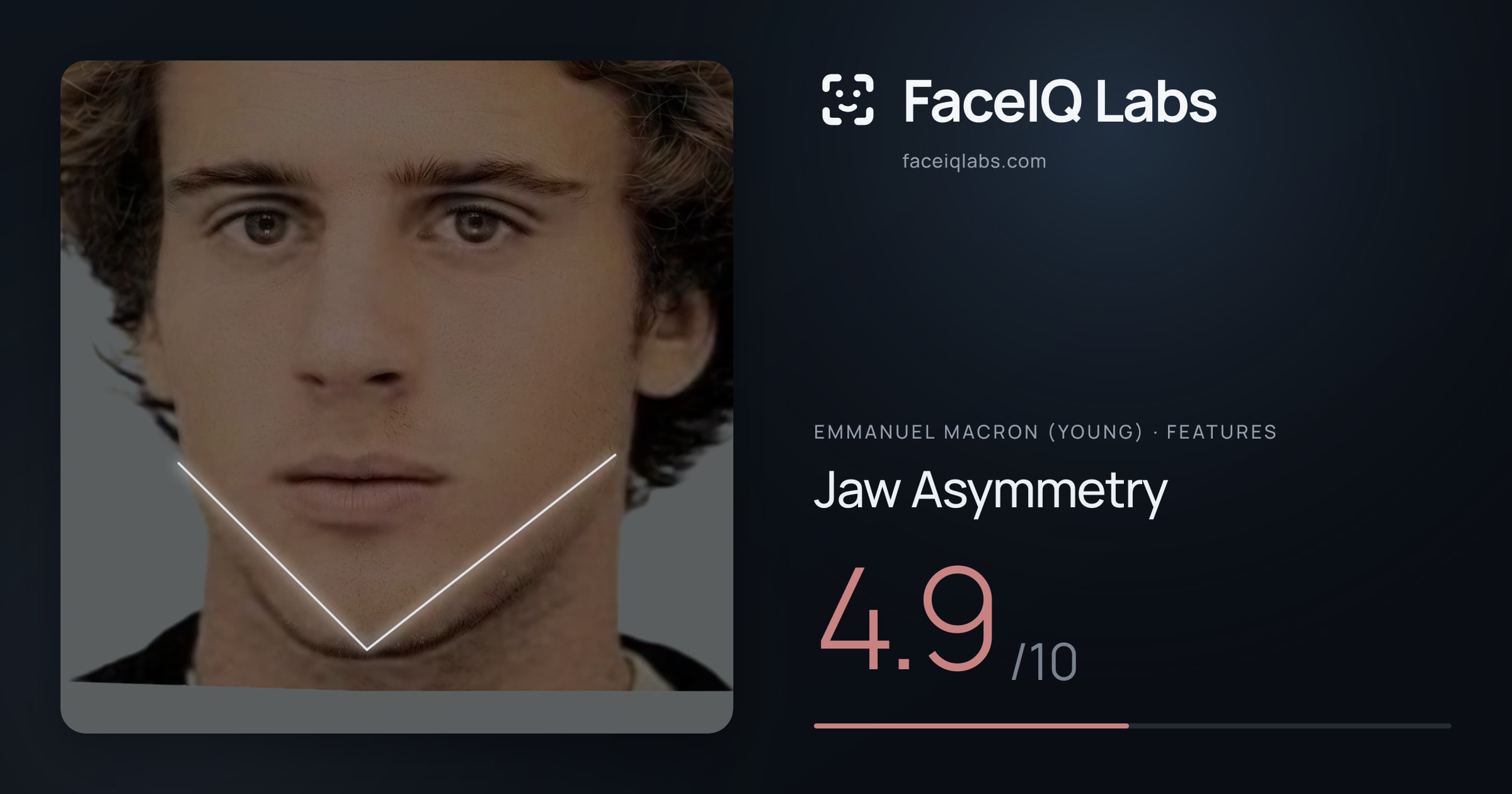 Emmanuel Macron (Young) Jaw Asymmetry: 4.9/10, drawn on the photo