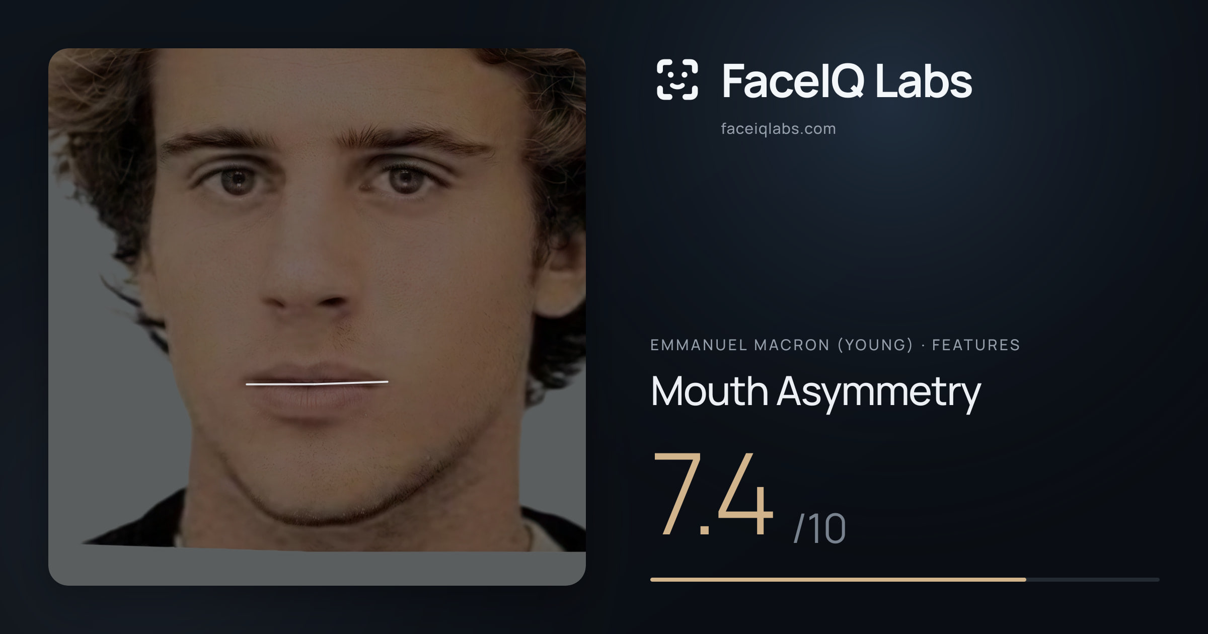 Emmanuel Macron (Young) Mouth Asymmetry: 7.4/10, drawn on the photo